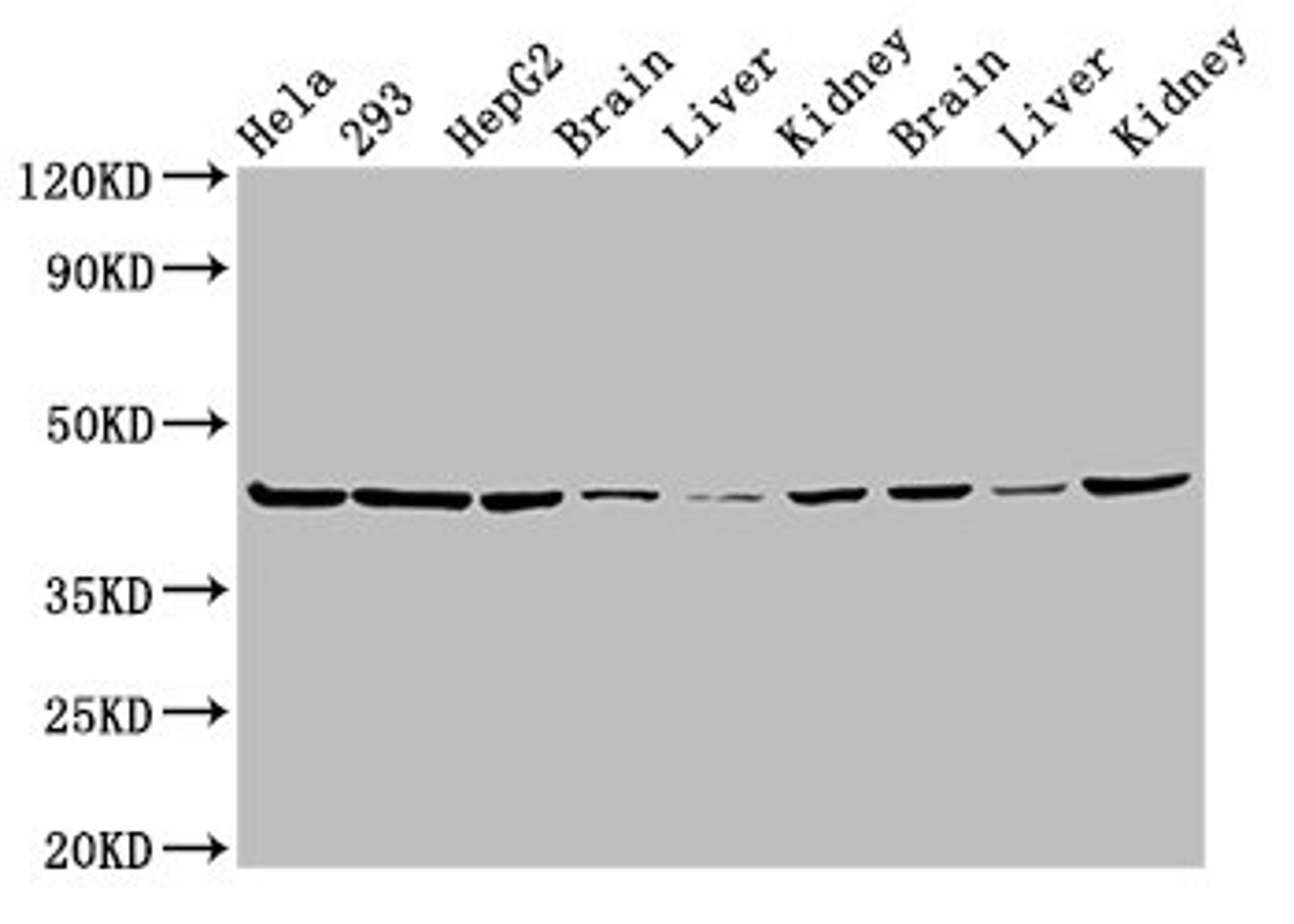 Western Blot. Positive WB detected in: Hela whole cell lysate, 293 whole cell lysate, HepG2 whole cell lysate, Mouse brain tissue, Mouse liver tissue, Mouse kidney tissue, Rat brain tissue, Rat liver tissue, Rat kidney tissue. All lanes: PSMC6 antibody at 3µg/ml. Secondary. Goat polyclonal to rabbit IgG at 1/50000 dilution. Predicted band size: 45 kDa. Observed band size: 45 kDa