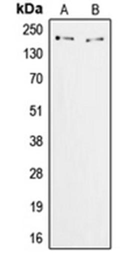 Western blot analysis of HeLa (Lane 1), COS7 (Lane 2) whole cell lysates using ZFP106 antibody