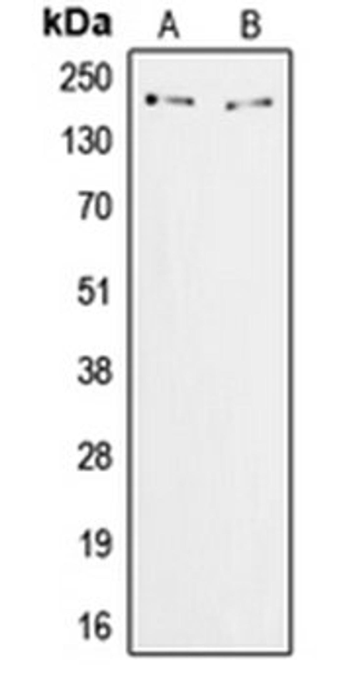 Western blot analysis of HeLa (Lane 1), COS7 (Lane 2) whole cell lysates using ZFP106 antibody