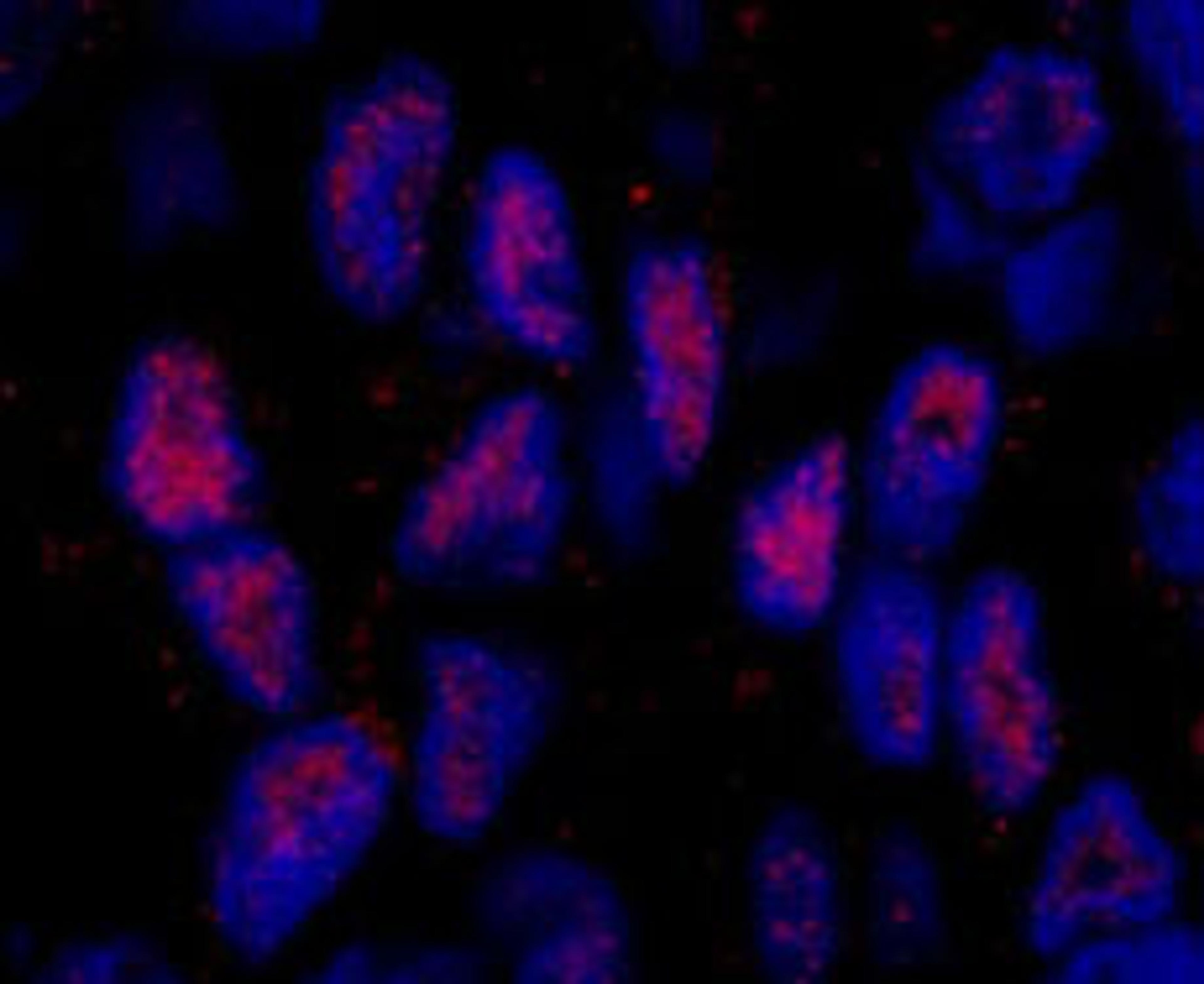 Detection of human MAML2 by immunohistochemistry.