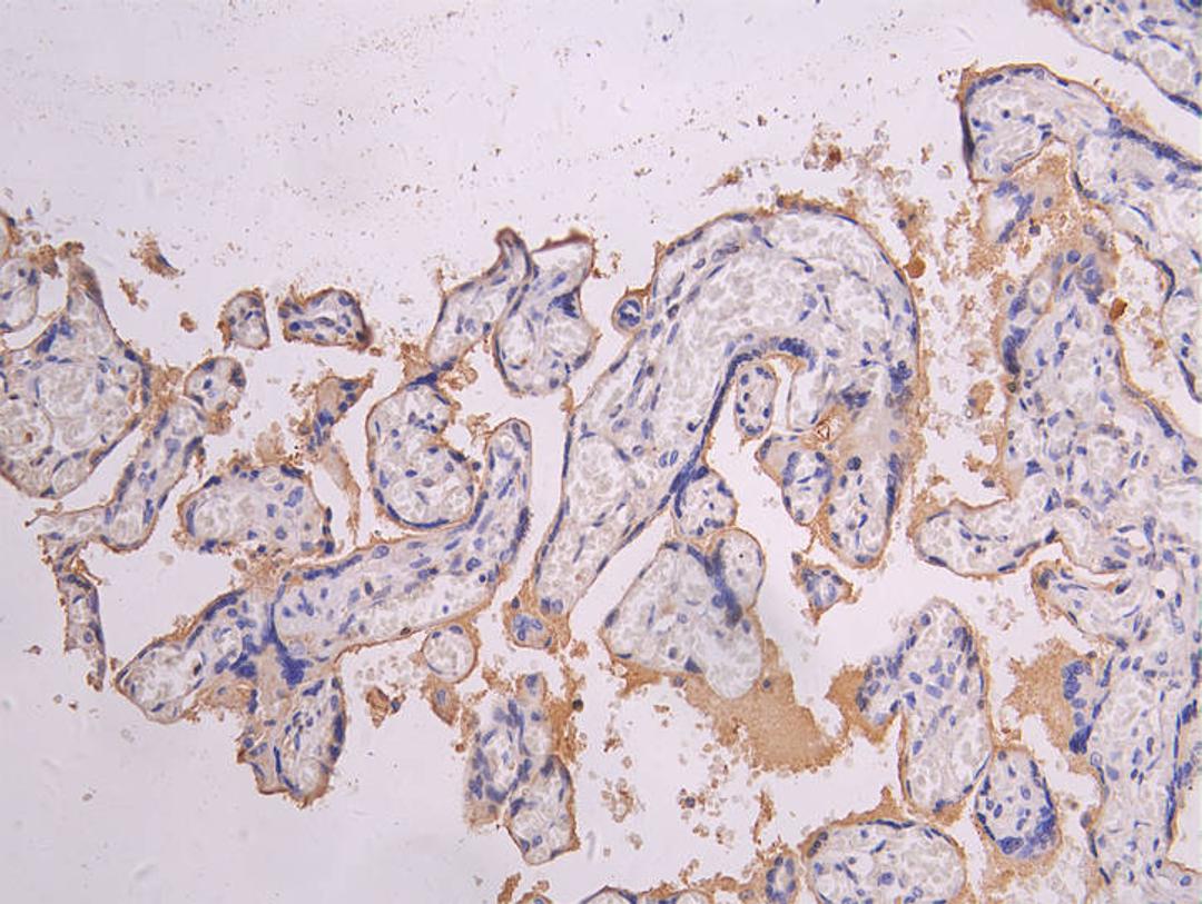 IHC image of CSB-RA835695MA1HU diluted at 1:200 and staining in paraffin-embedded human placenta tissue performed on a Leica BondTM system. After dewaxing and hydration, antigen retrieval was mediated by high pressure in a citrate buffer (pH 6.0). Section was blocked with 10% normal goat serum 30min at RT. Then primary antibody (1% BSA) was incubated at 4°C overnight. The primary is detected by a Goat anti-human polymer IgG labeled by HRP and visualized using 0.05% DAB.