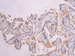 IHC image of CSB-RA835695MA1HU diluted at 1:200 and staining in paraffin-embedded human placenta tissue performed on a Leica BondTM system. After dewaxing and hydration, antigen retrieval was mediated by high pressure in a citrate buffer (pH 6.0). Section was blocked with 10% normal goat serum 30min at RT. Then primary antibody (1% BSA) was incubated at 4°C overnight. The primary is detected by a Goat anti-human polymer IgG labeled by HRP and visualized using 0.05% DAB.