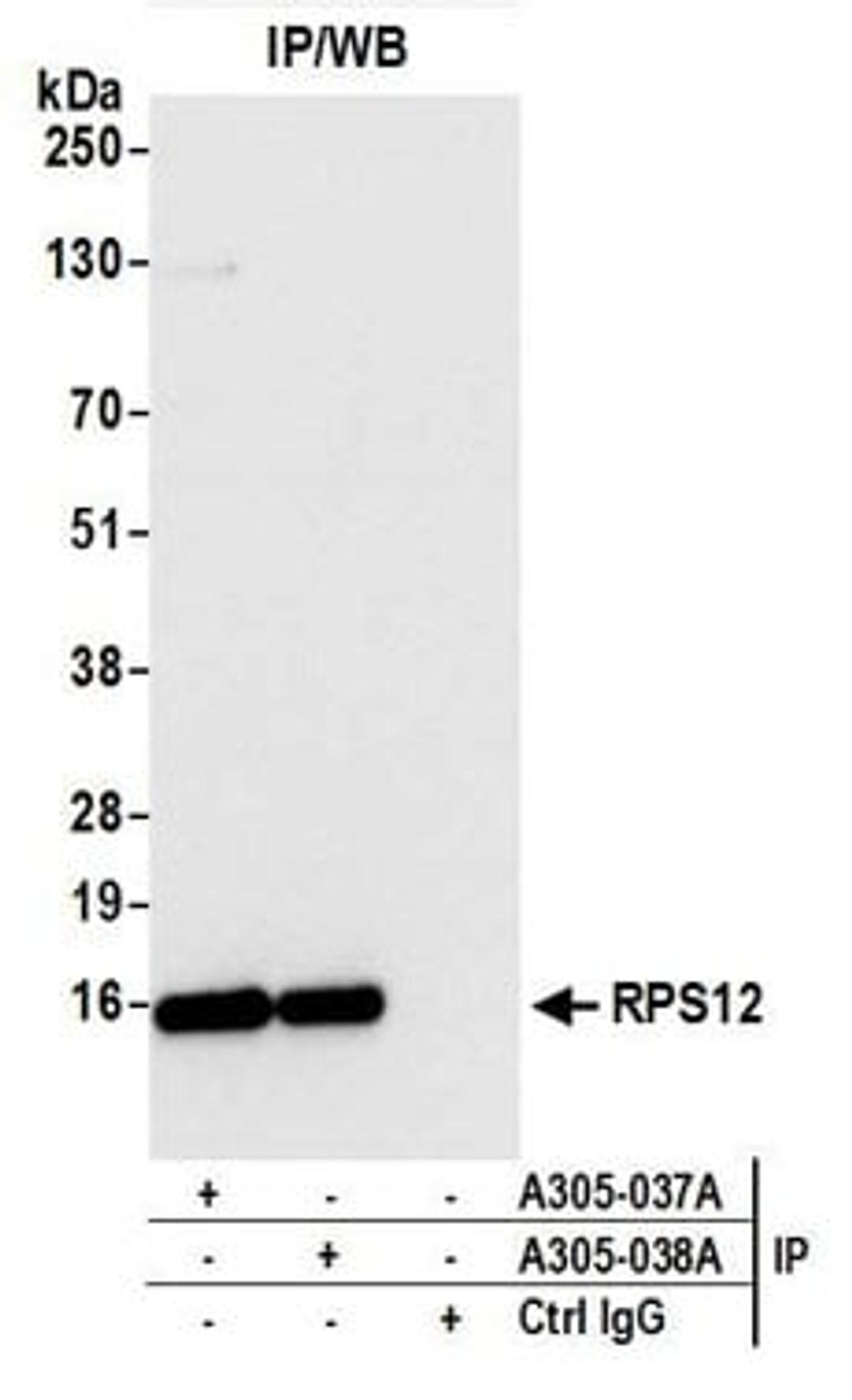 Detection of human RPS12 by western blot of immunoprecipitates.