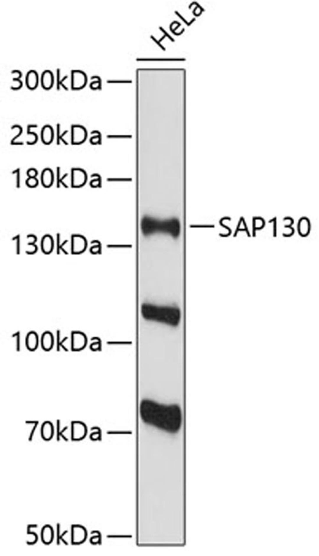 Western blot - SAP130 antibody (A13898)