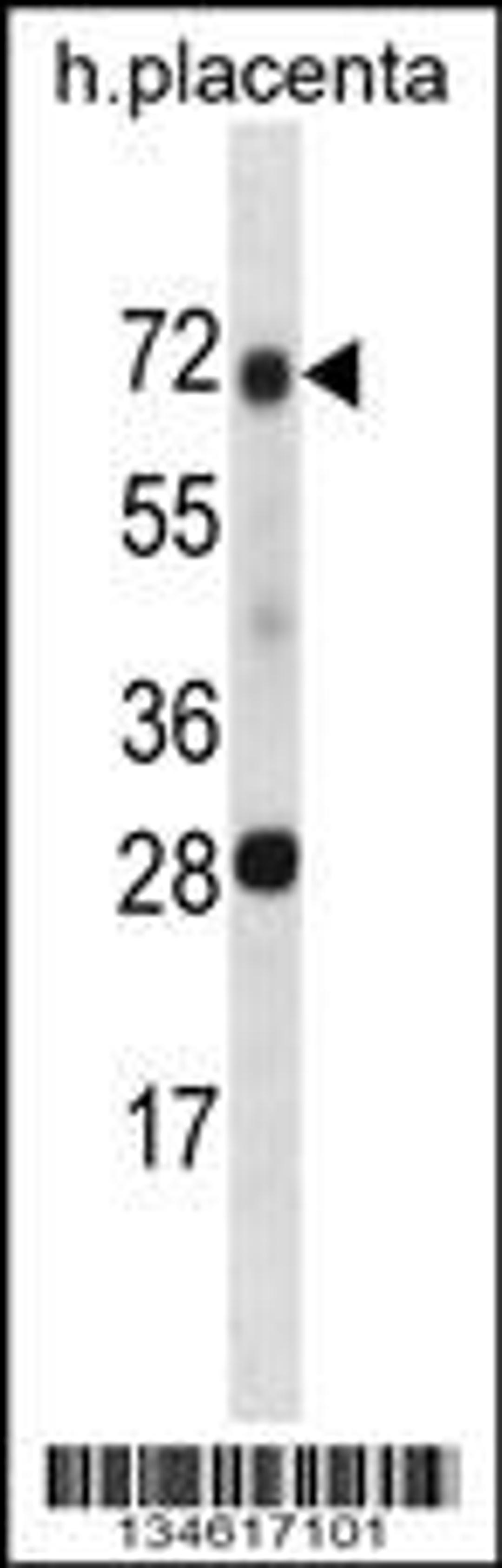 Western blot analysis in human placenta tissue lysates (35ug/lane).