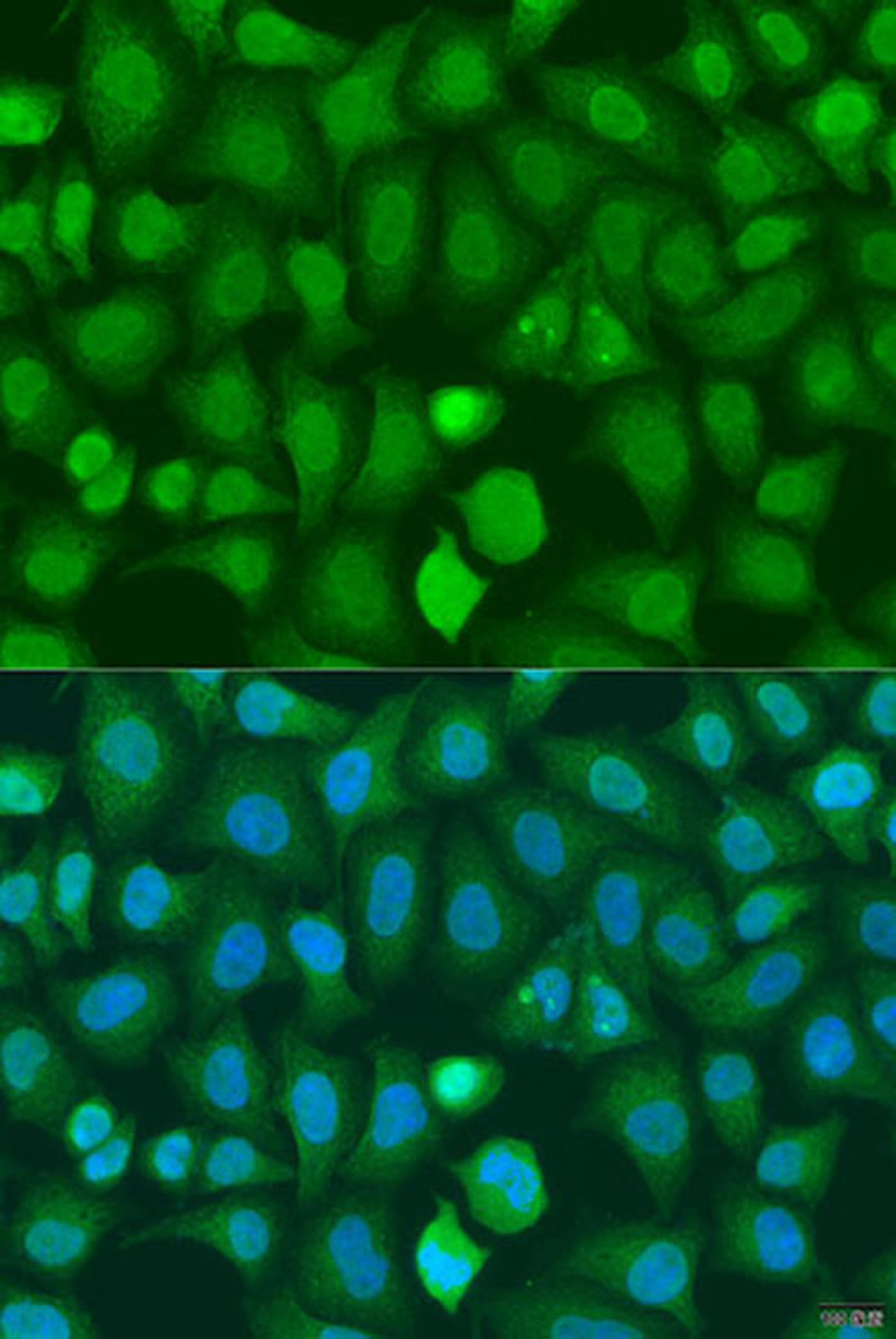 Immunofluorescence - CHD1 antibody (A15038)