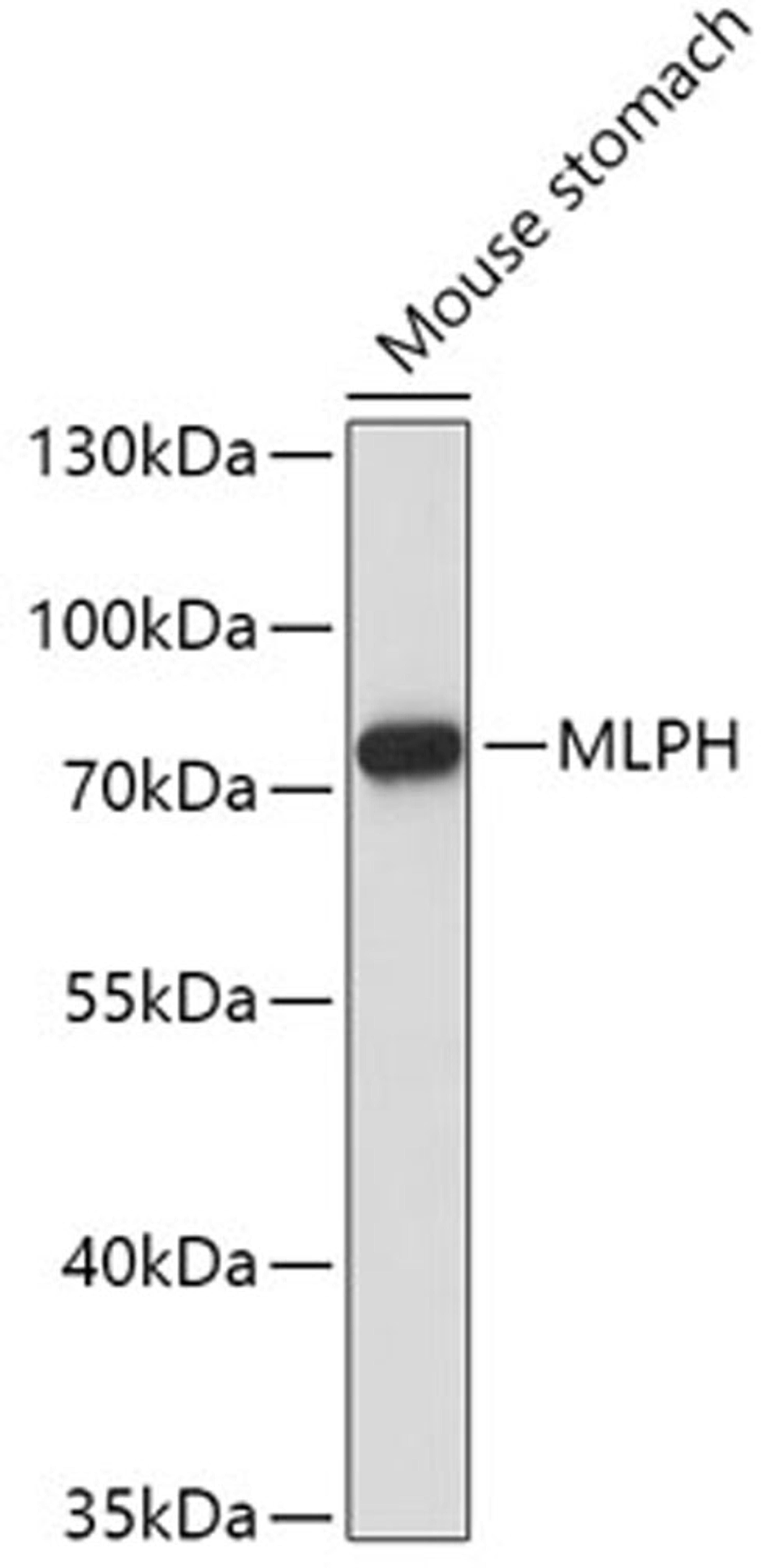 Western blot - MLPH antibody (A6656)