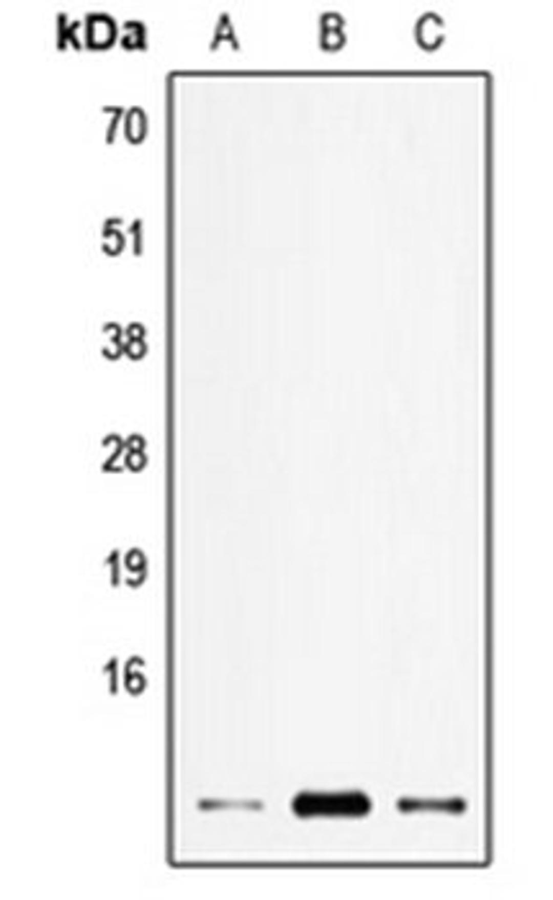 Western blot analysis of HEK293T (Lane 1), SP2/0 (Lane 2), H9C2 (Lane 3) whole cell lysates using ELOF1 antibody