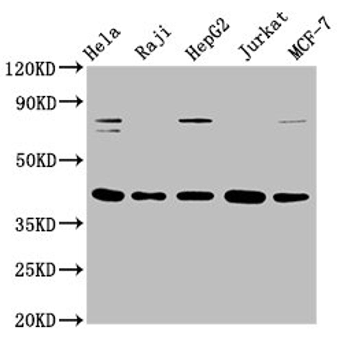 Western Blot. Positive WB detected in: Hela whole cell lysate, Raji whole cell lysate, HepG2 whole cell lysate, Jurkat whole cell lysate, MCF-7 whole cell lysate. All lanes: FEN1 antibody at 0.775μg/ml. Secondary. Goat polyclonal to rabbit IgG at 1/50000 dilution. Predicted band size: 43, 36 KDa. Observed band size: 43 KDa. 