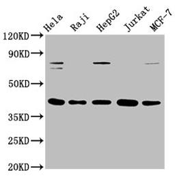 Western Blot. Positive WB detected in: Hela whole cell lysate, Raji whole cell lysate, HepG2 whole cell lysate, Jurkat whole cell lysate, MCF-7 whole cell lysate. All lanes: FEN1 antibody at 0.775μg/ml. Secondary. Goat polyclonal to rabbit IgG at 1/50000 dilution. Predicted band size: 43, 36 KDa. Observed band size: 43 KDa. 