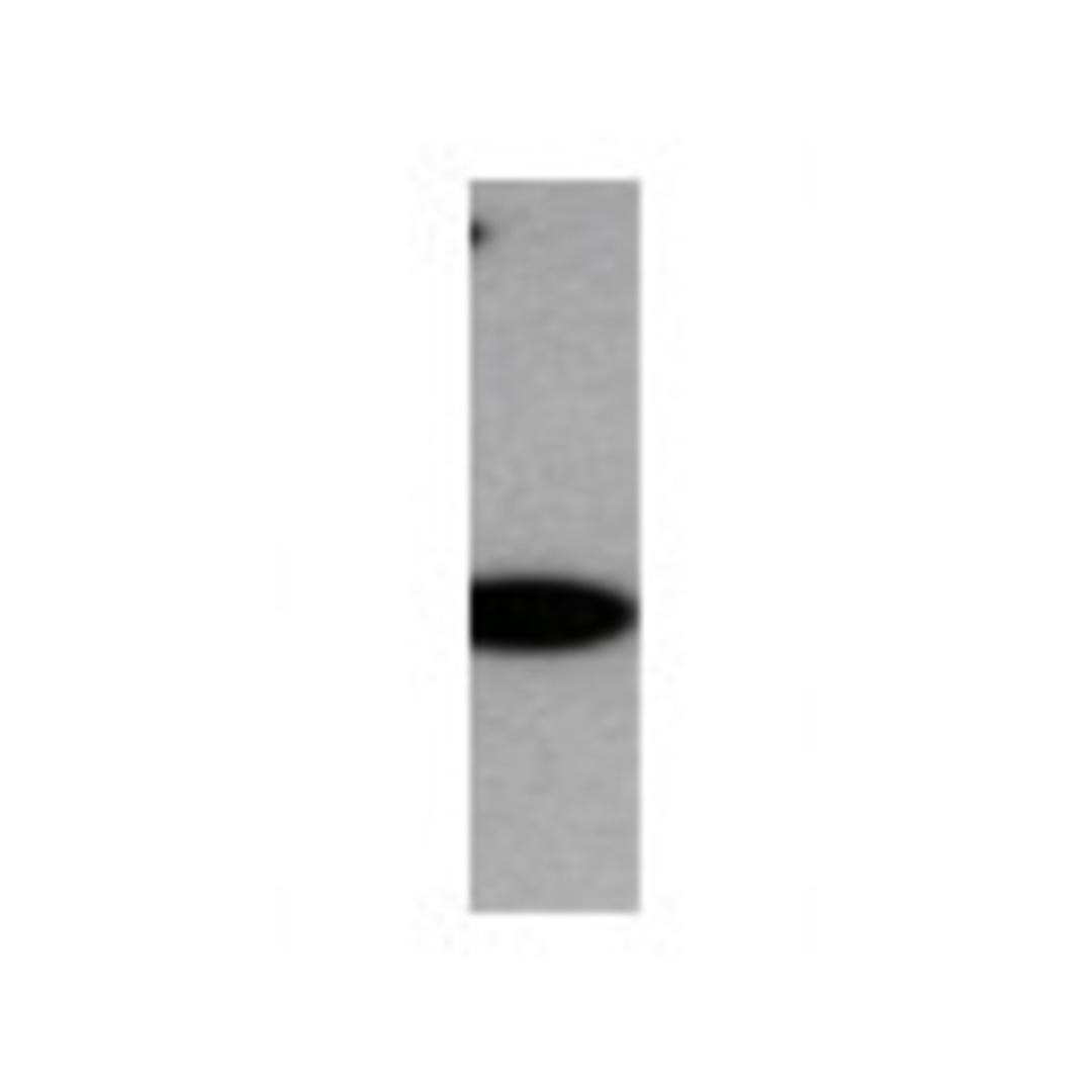 Western Blot: Myosin heavy chain 11 Antibody [21370002] - Western Blot was performed using affinity purified SEQer MYH11 antibody, aa(1572-1671) antibody. The lanes contain 5-30ug of a whole cell extract.  Final concentration of antibodies = 0.1ug/ml (1:10,000 dilution). The blot was probed overnight with the SEQer MYH11 antibody, aa(1572-1671) antibody.  Blot was then washed according to protocol and probed with goat-anti-Rabbit-HRP conjugate at 1:5000 dilution, washed and developed using chemiluminescence (film exposure 5-30sec).  The protein was detected as represented by the band shown.