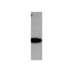 Western Blot: Myosin heavy chain 11 Antibody [21370002] - Western Blot was performed using affinity purified SEQer MYH11 antibody, aa(1572-1671) antibody. The lanes contain 5-30ug of a whole cell extract.  Final concentration of antibodies = 0.1ug/ml (1:10,000 dilution). The blot was probed overnight with the SEQer MYH11 antibody, aa(1572-1671) antibody.  Blot was then washed according to protocol and probed with goat-anti-Rabbit-HRP conjugate at 1:5000 dilution, washed and developed using chemiluminescence (film exposure 5-30sec).  The protein was detected as represented by the band shown.