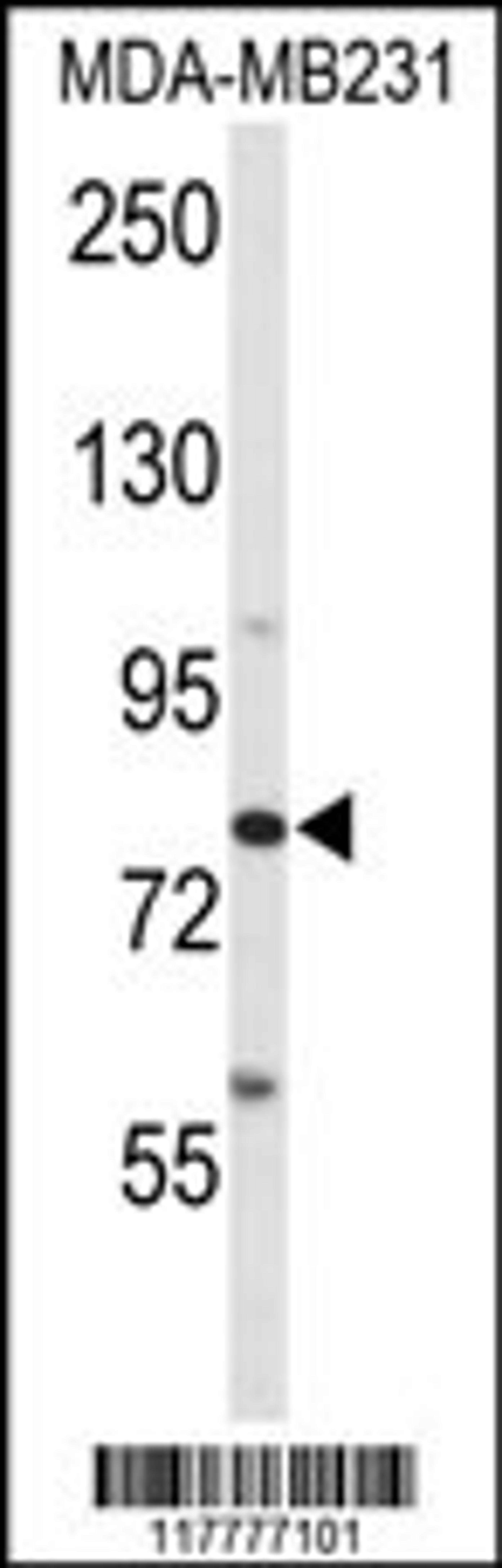 Western blot analysis of ADAM9 Antibody in MDA-MB231 cell line lysates (35ug/lane)