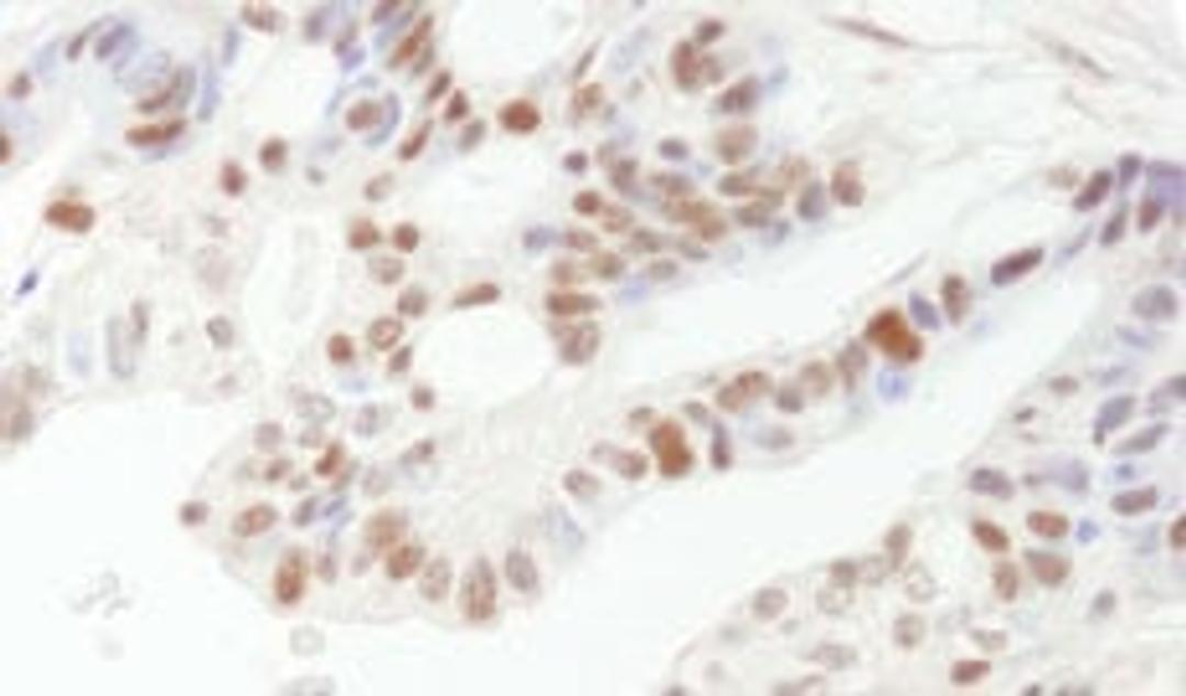 Detection of human DFF45/DFFA by immunohistochemistry.