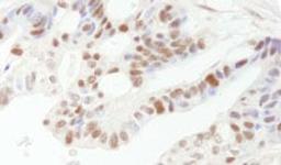 Detection of human DFF45/DFFA by immunohistochemistry.