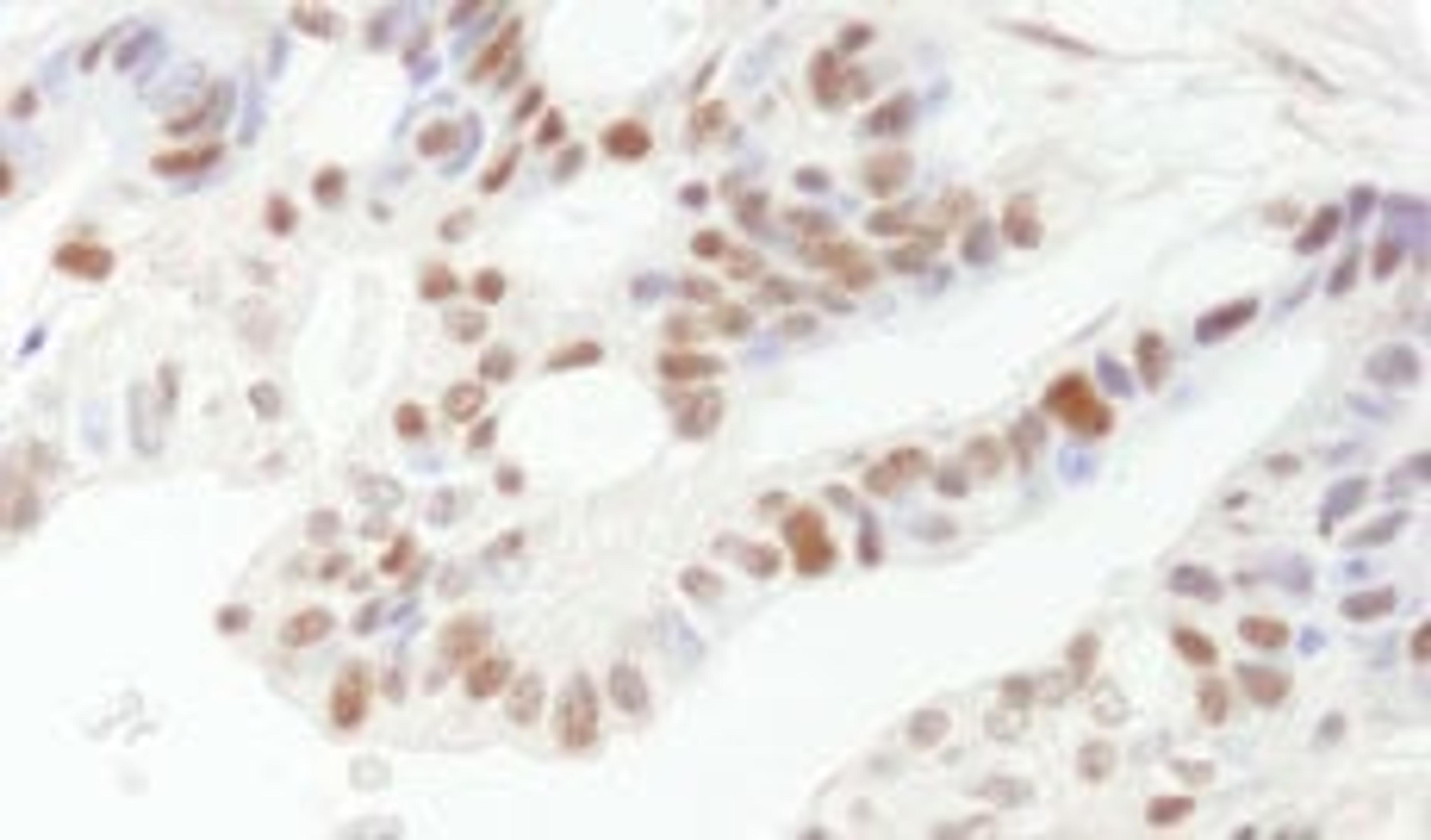 Detection of human DFF45/DFFA by immunohistochemistry.