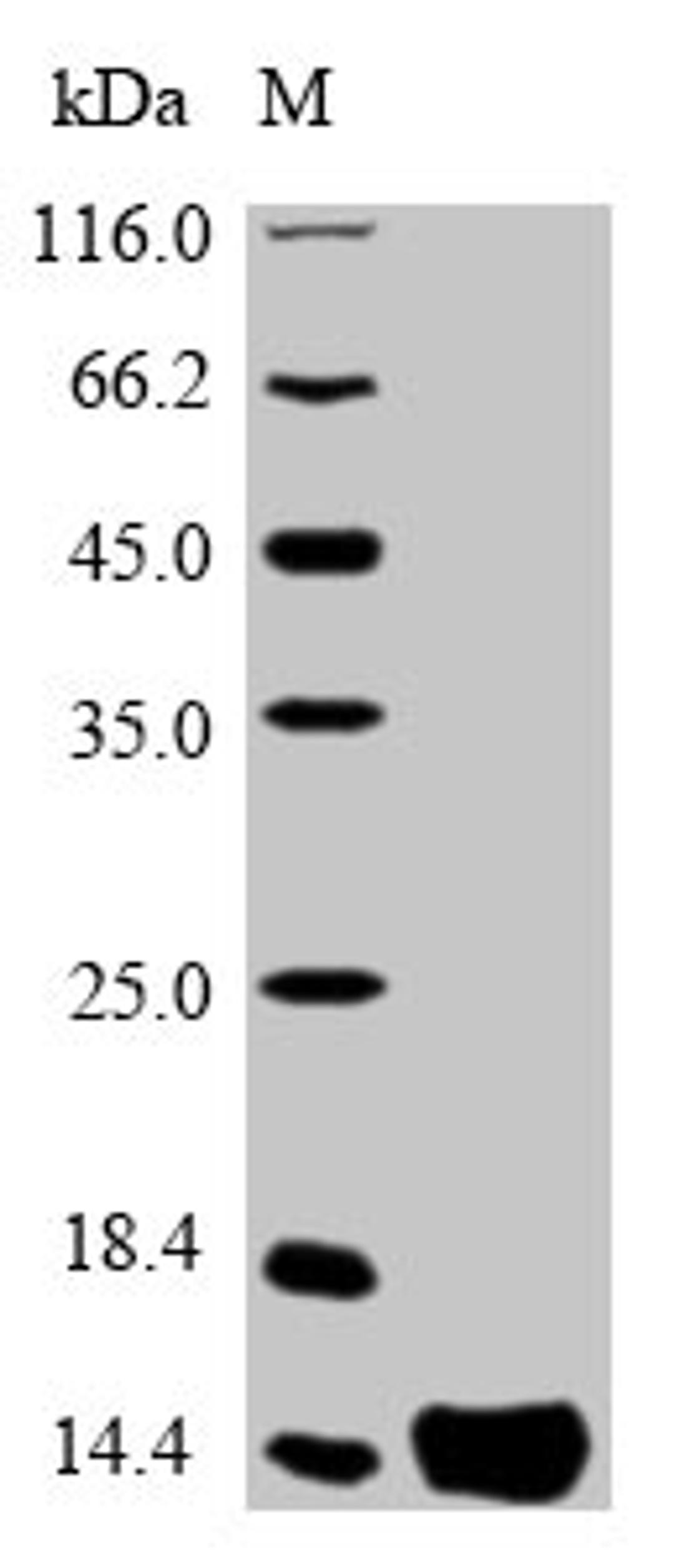 (Tris-Glycine gel) Discontinuous SDS-PAGE (reduced) with 5% enrichment gel and 15% separation gel.
