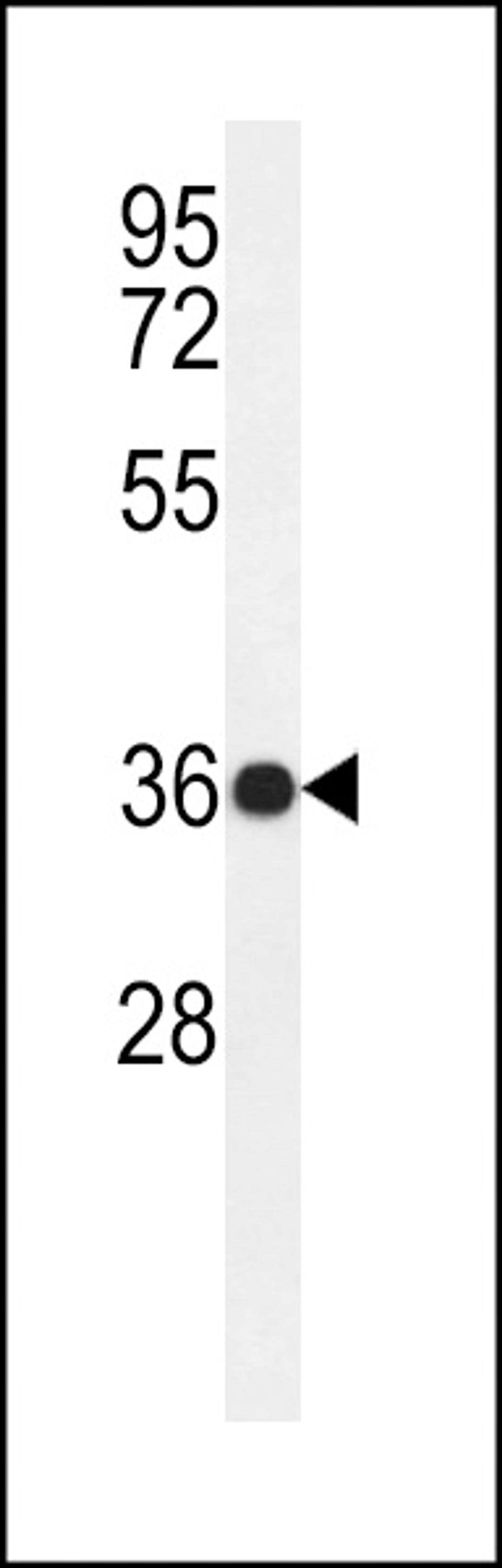 Western blot analysis of PAR6G Antibody in ZR-75-1 cell line lysates (35ug/lane)