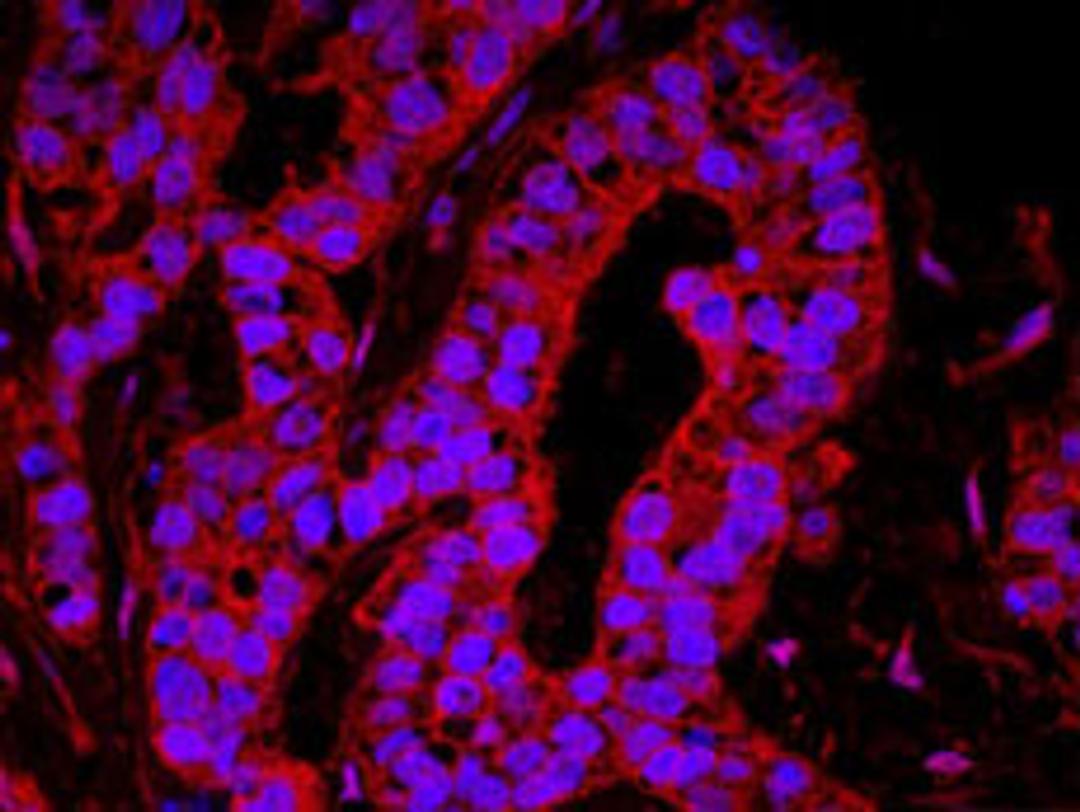 Detection of human YAP1 by immunohistochemistry.