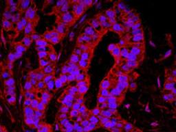 Detection of human YAP1 by immunohistochemistry.