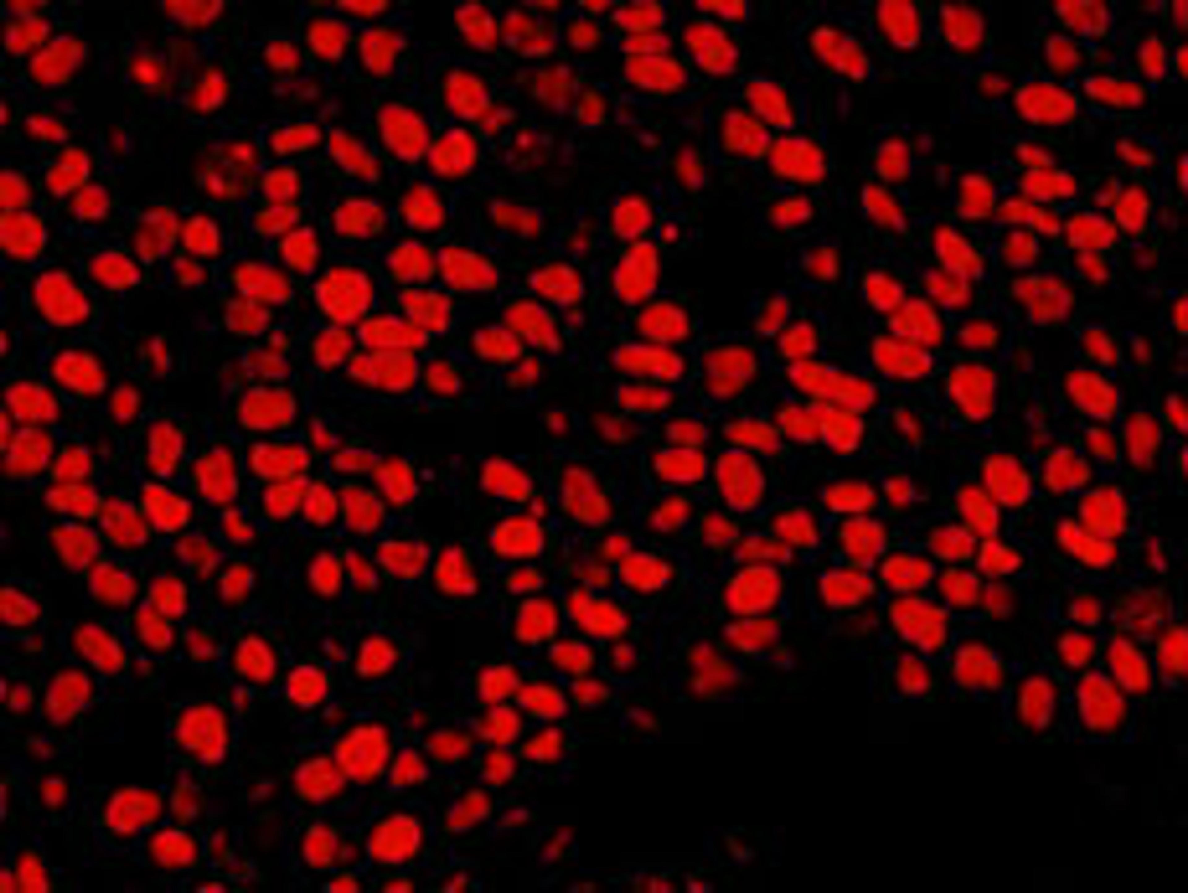 Detection of human NUMA by immunohistochemistry.