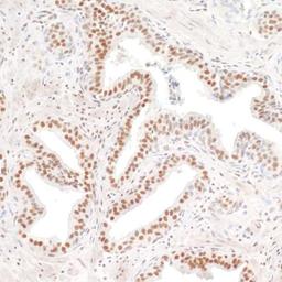 Detection of human PRMT1 by IHC.