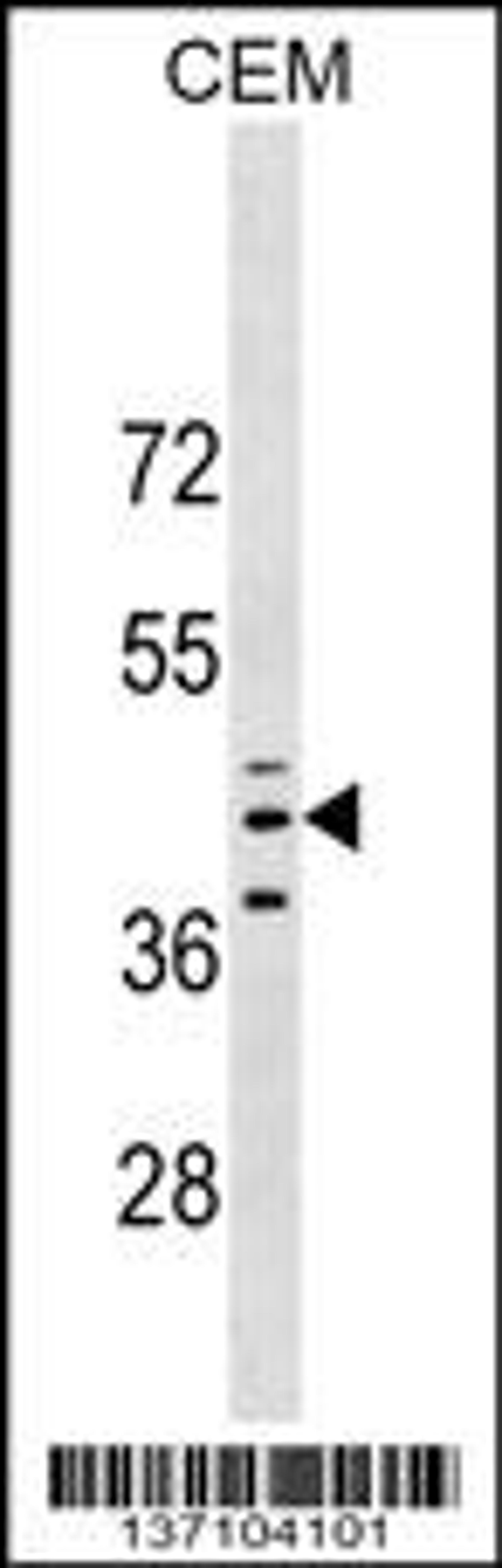 Western blot analysis in CEM cell line lysates (35ug/lane).