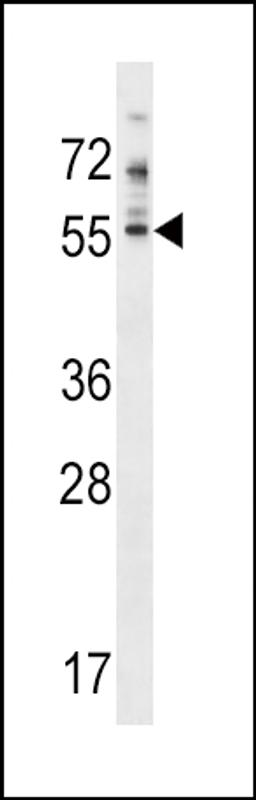 Western blot analysis in NCI-H460 cell line lysates (35ug/lane).