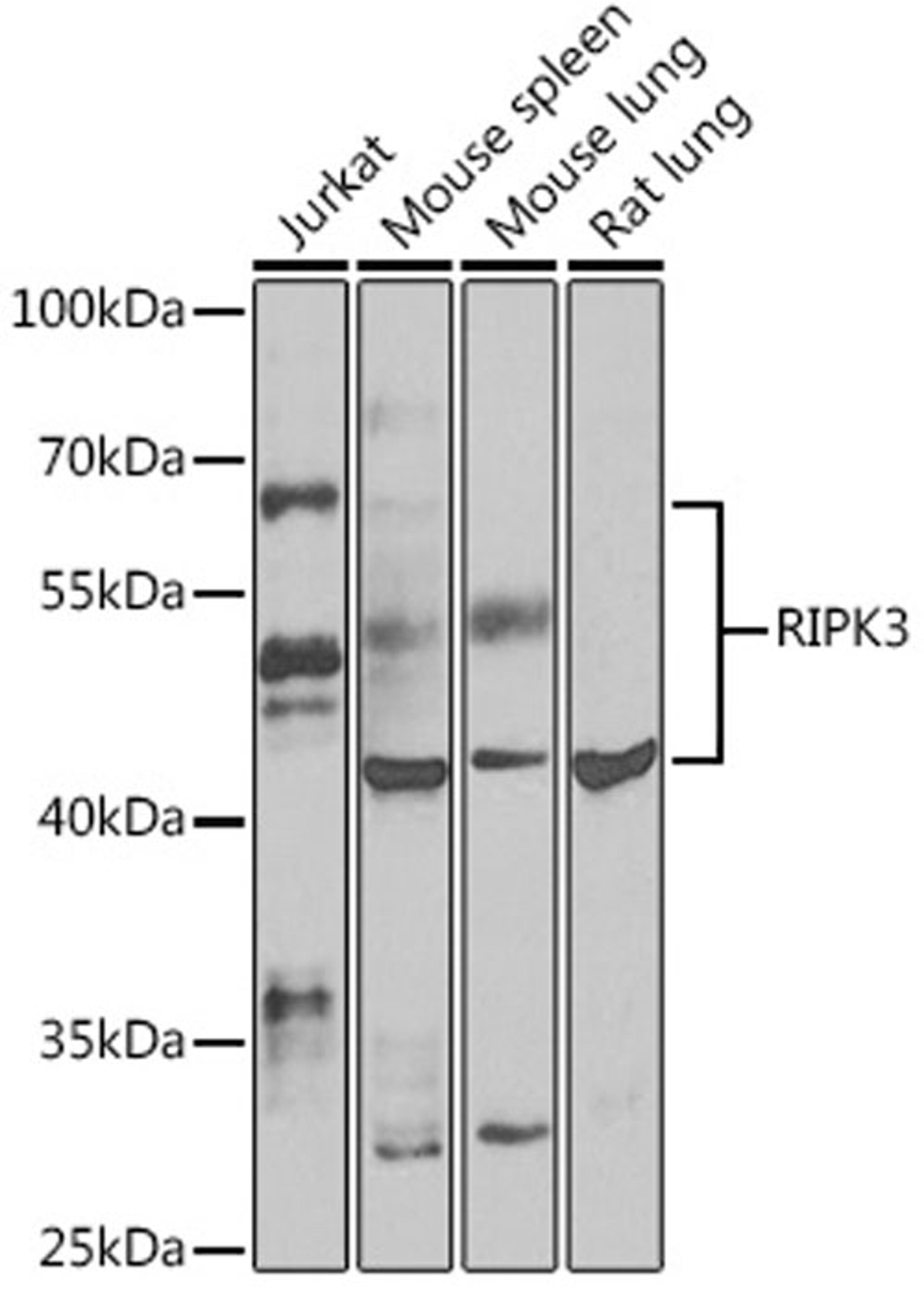 Western blot - RIPK3 antibody (A5431)