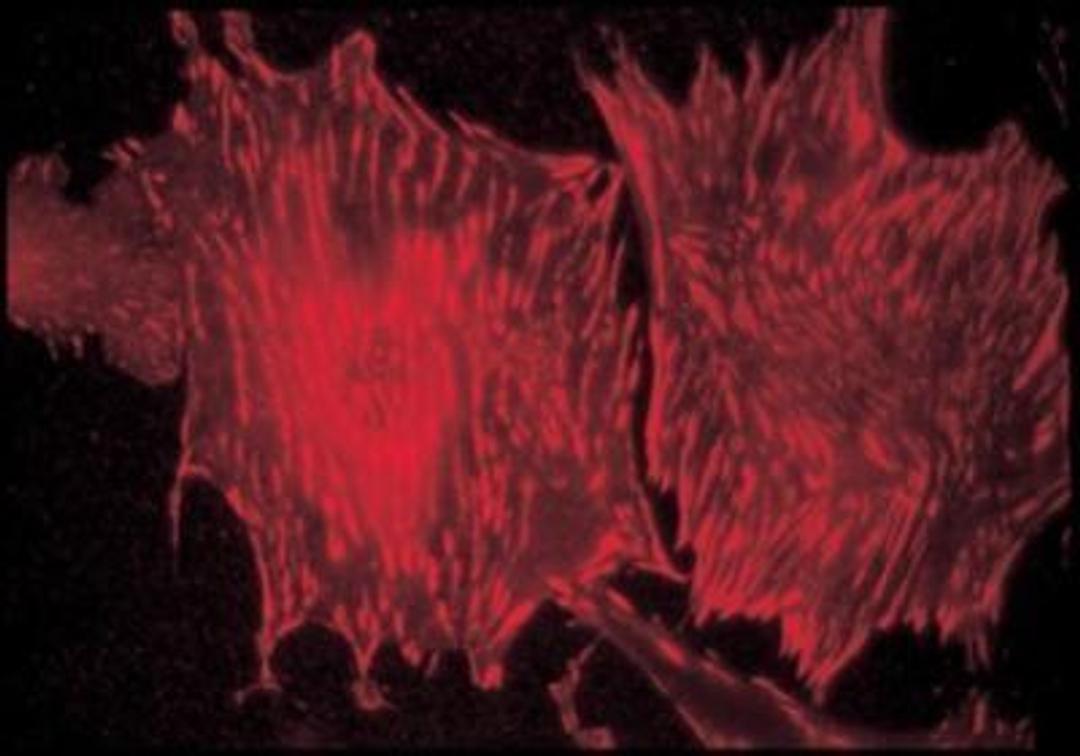 Immunocytochemistry/Immunofluorescence: Talin1 Antibody (8D4) [NB600-1029] - Immunofluorescent staining of rat embryo fibroblasts using Monoclonal Anti-Talin, (clone no. 8d4, Cat. No. T3287), showing reactivity with focal adhesions. Data supplied by Dr. C. Otey, University of North Carolina, Chapel Hill, NC.