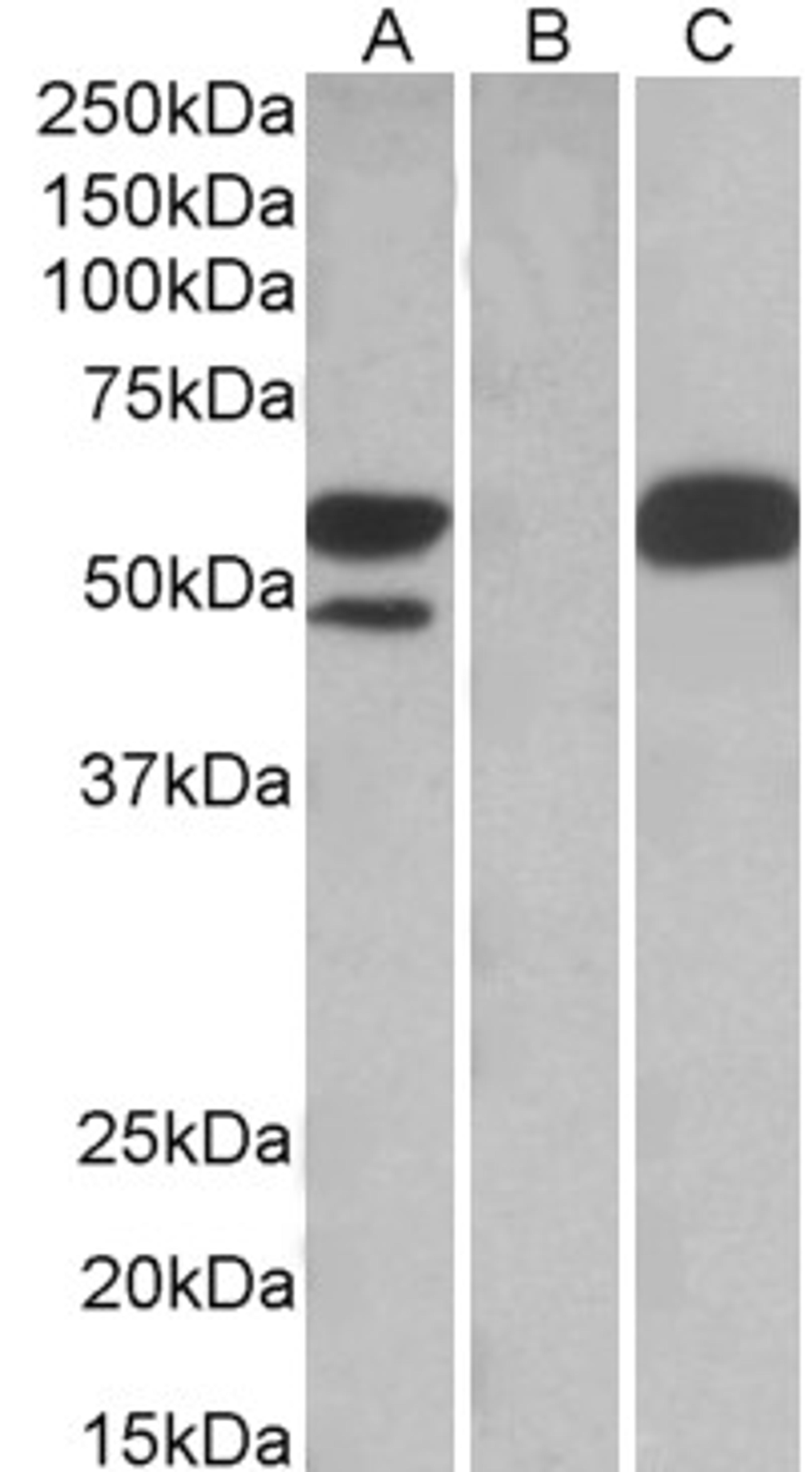 HEK293 lysate (10ug protein in RIPA buffer) overexpressing Human TRIM21 with C-terminal MYC tag probed with 46-314 (1ug/ml) in Lane A and probed with anti-MYC Tag (1/1000) in lane C. Mock-transfected HEK293 probed with 46-314 (1mg/ml) in Lane B. Primary