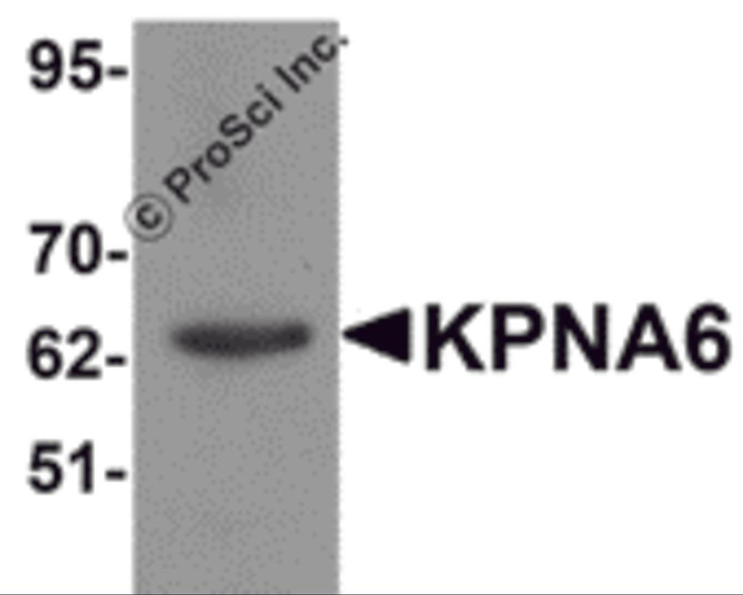 Western blot analysis of KPNA6 in 293 cell lysate with KPNA6 antibody at 1 μg/mL.