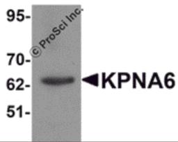 Western blot analysis of KPNA6 in 293 cell lysate with KPNA6 antibody at 1 μg/mL.