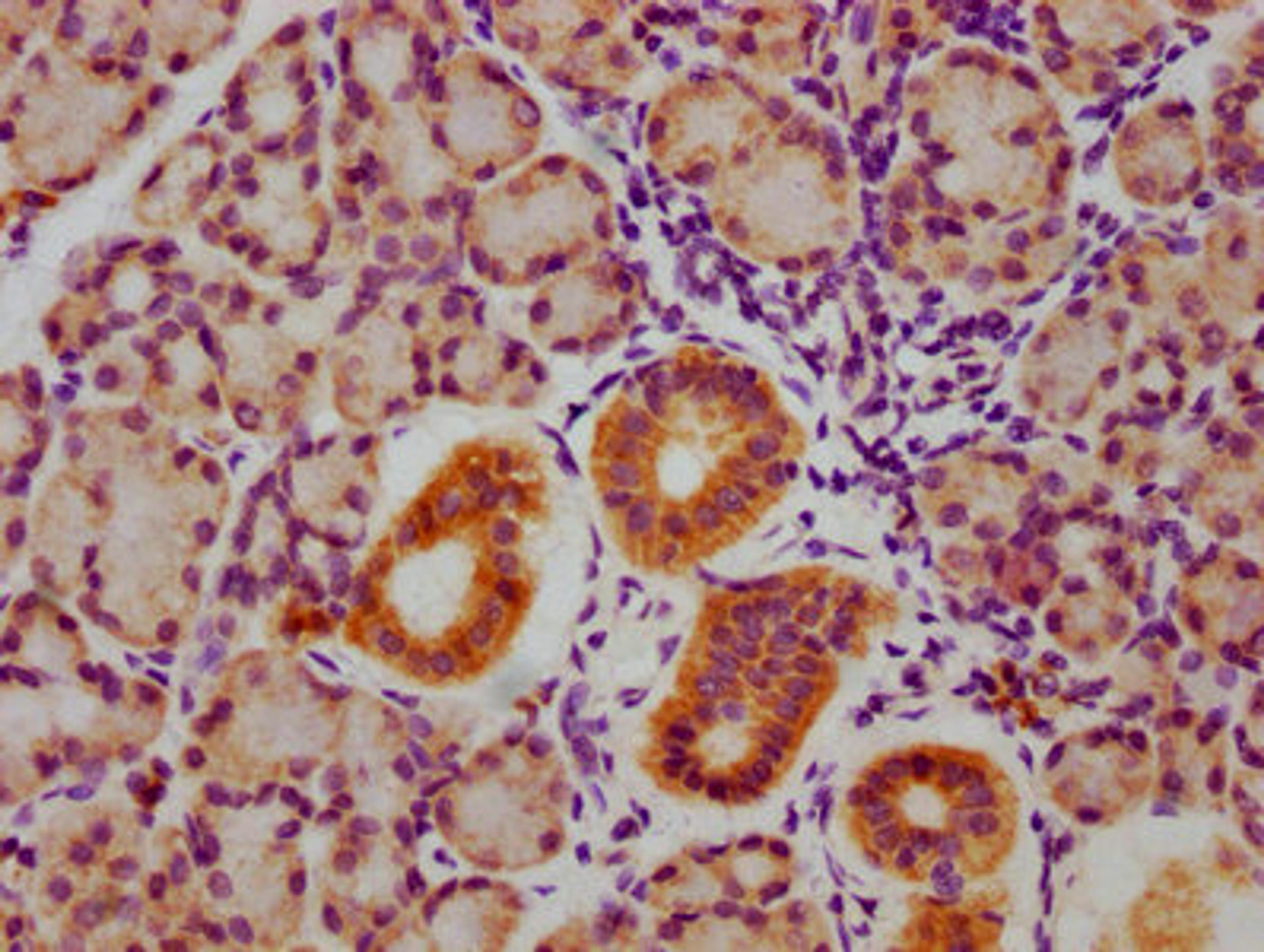 IHC image of CSB-RA009962A216phHU diluted at 1:100 and staining in paraffin-embedded human pancreatic tissue performed on a Leica BondTM system. After dewaxing and hydration, antigen retrieval was mediated by high pressure in a citrate buffer (pH 6.0). Section was blocked with 10% normal goat serum 30min at RT. Then primary antibody (1% BSA) was incubated at 4℃ overnight. The primary is detected by a biotinylated secondary antibody and visualized using an HRP conjugated SP system.
