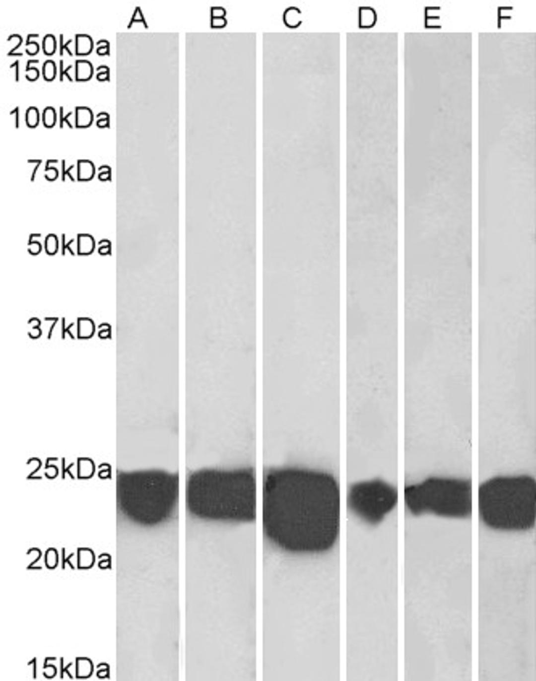 46-132 (0.001ug/ml) staining of Human Cerebellum (A), Human Frontal Cortex (B), Human Hippocampus (C) Mouse Fetal Brain (D), Mouse Brain (E) and Rat Brain (F) lysates (35ug protein in RIPA buffer). Detected by chemiluminescence.