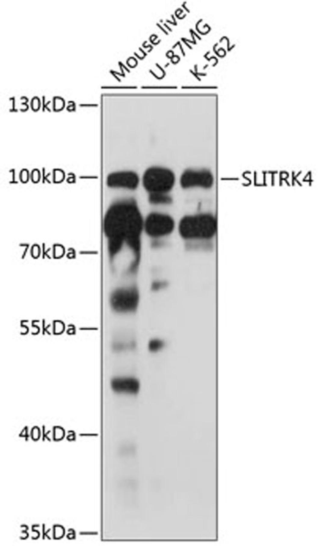 Western blot - SLITRK4 antibody (A12936)