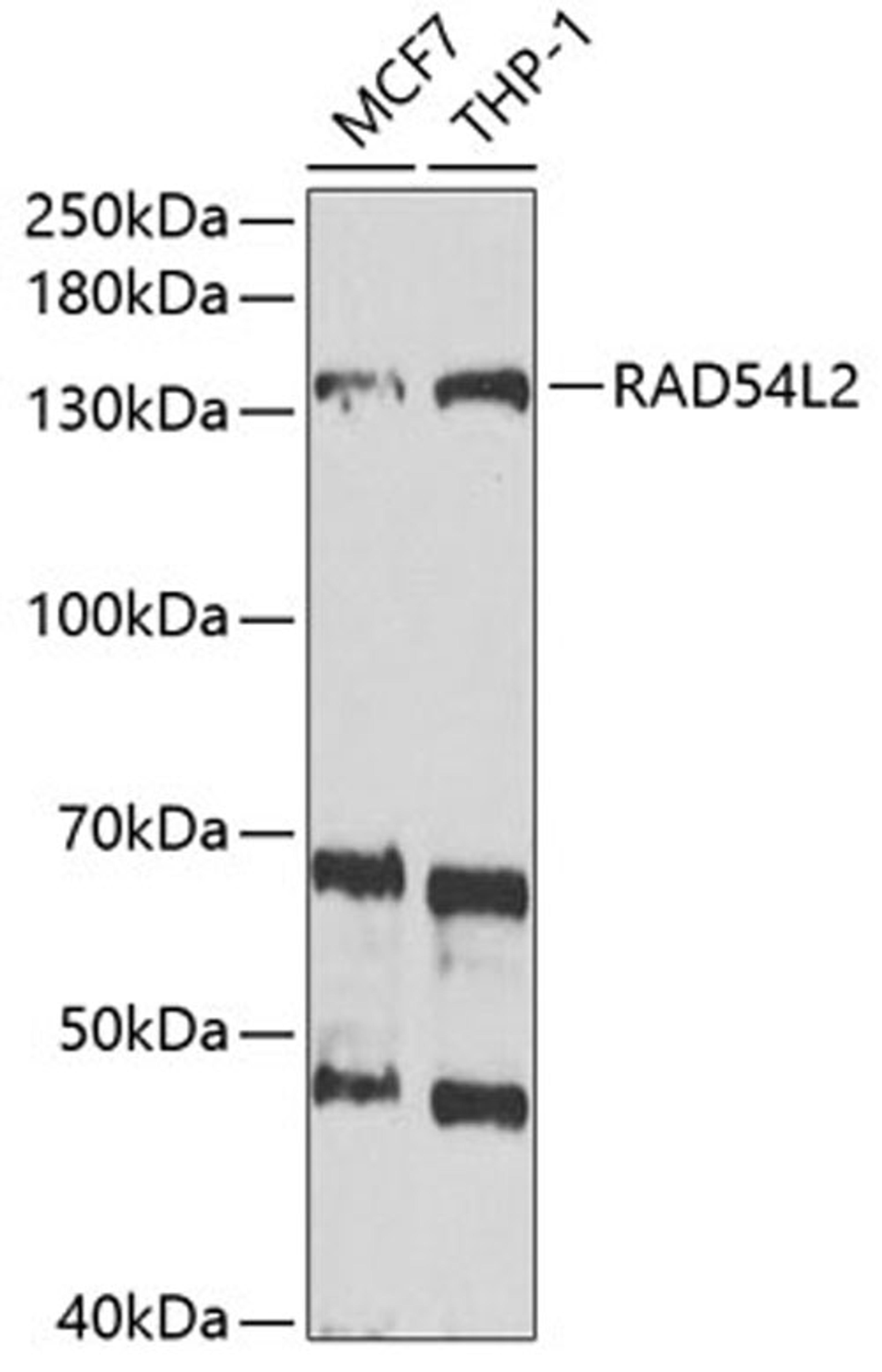 Western blot - RAD54L2 antibody (A6144)