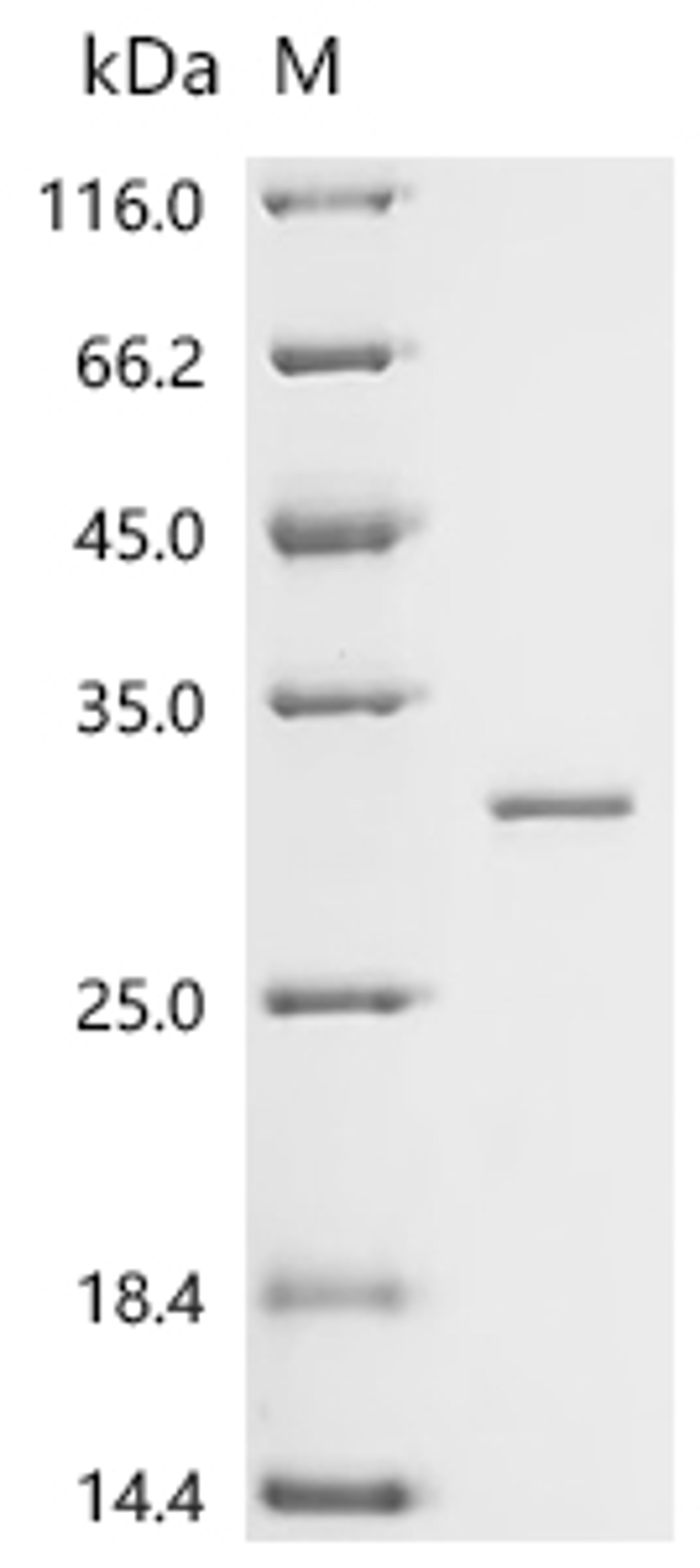 (Tris-Glycine gel) Discontinuous SDS-PAGE (reduced) with 5% enrichment gel and 15% separation gel.