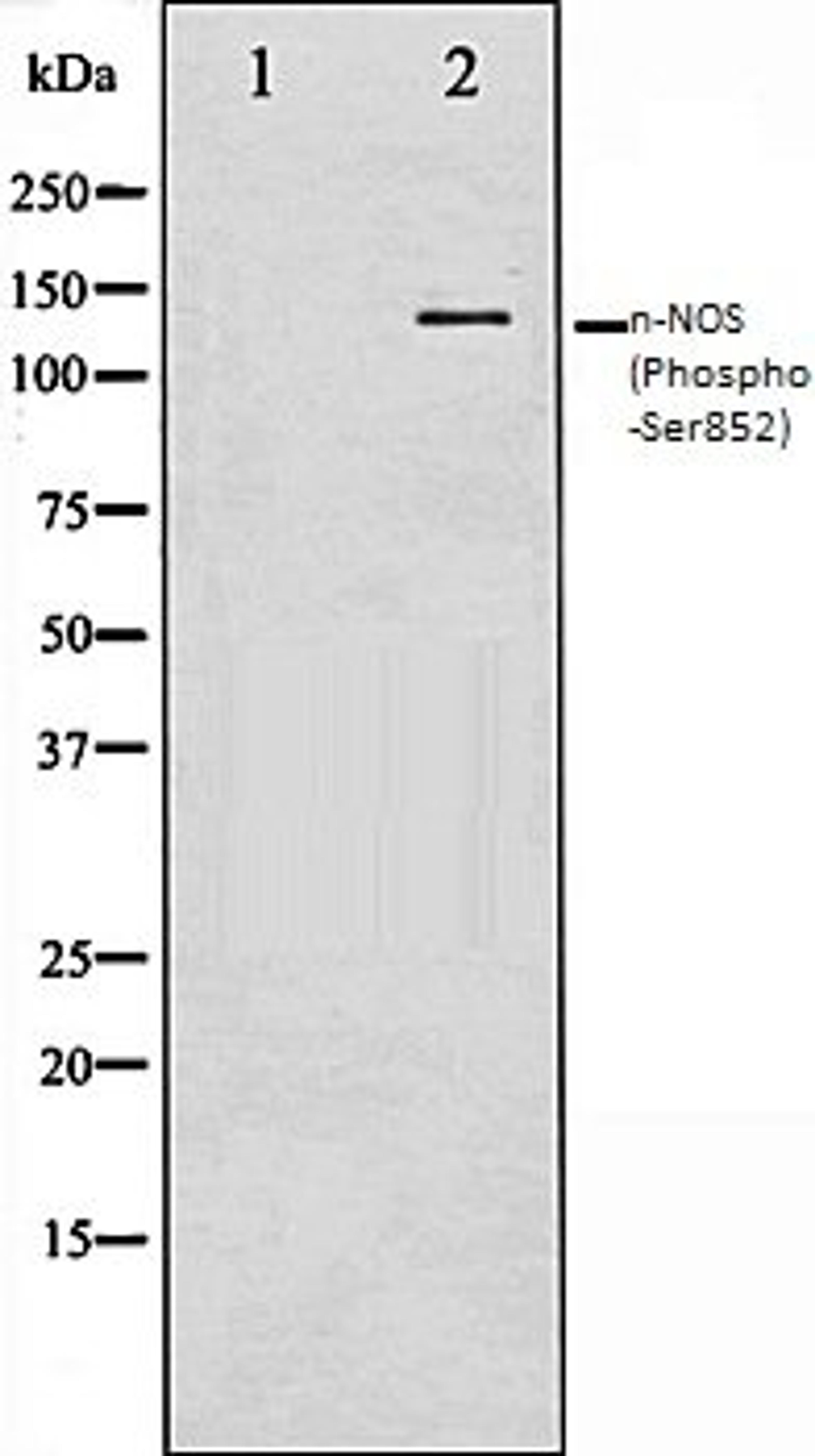 Western blot analysis of A549 whole cell lysates using n-NOS (Phospho-Ser852) antibody, The lane on the left is treated with the antigen-specific peptide.