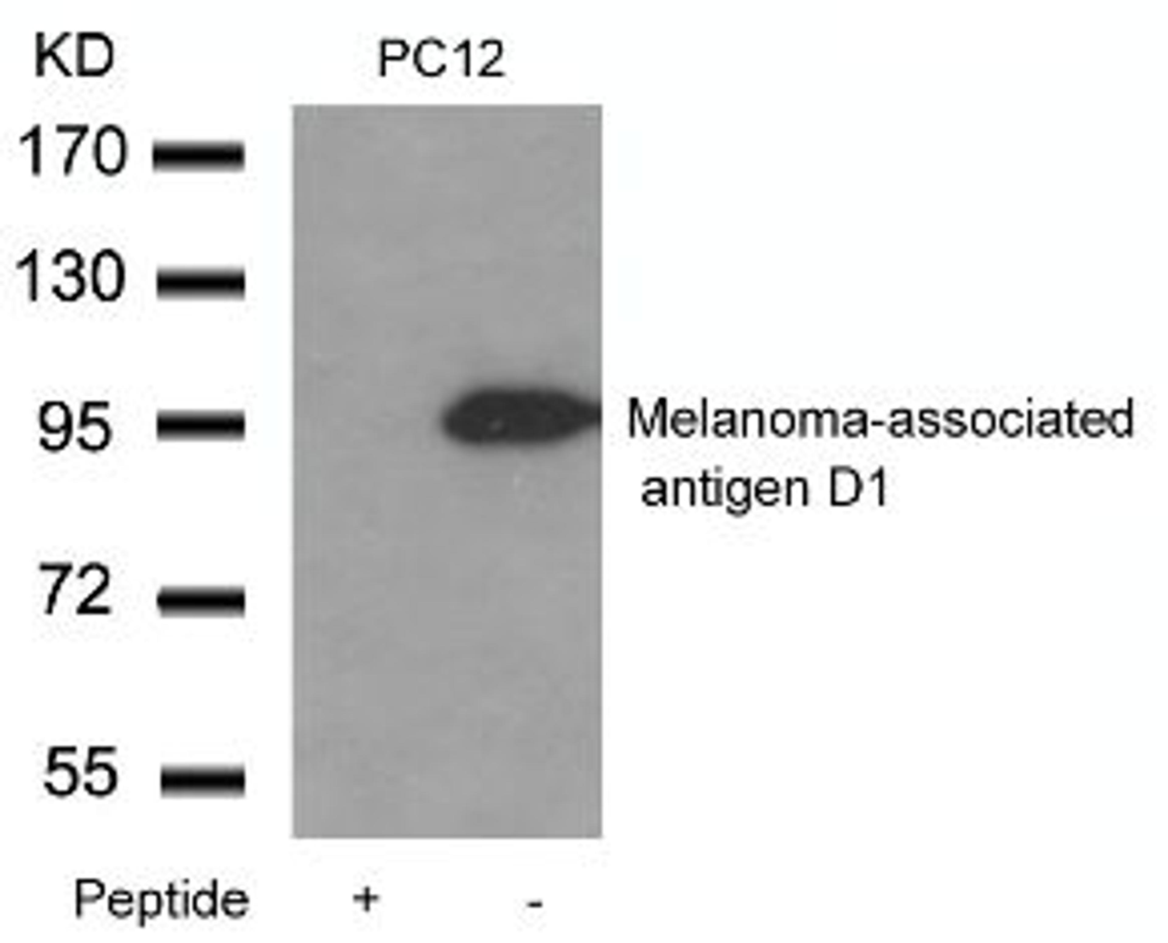 Western blot analysis of lysed extracts from PC12 cells using Melanoma-associated antigen D1 Antibody.