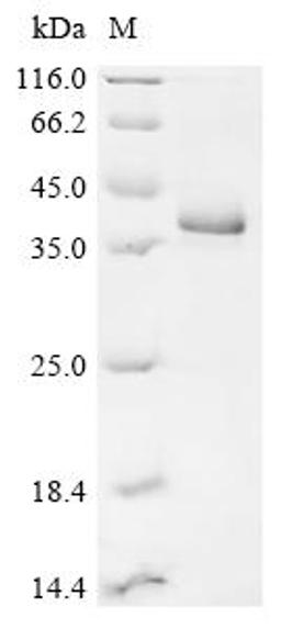(Tris-Glycine gel) Discontinuous SDS-PAGE (reduced) with 5% enrichment gel and 15% separation gel.