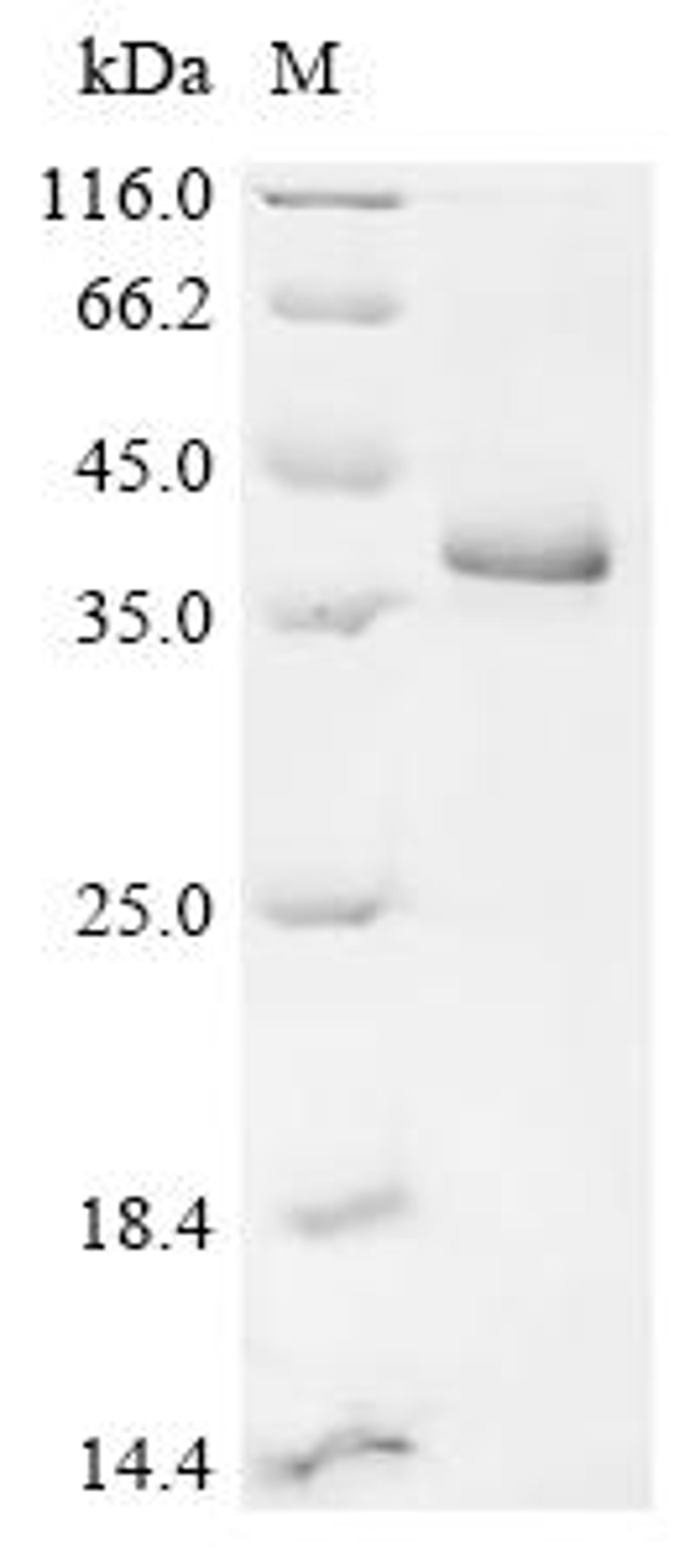 (Tris-Glycine gel) Discontinuous SDS-PAGE (reduced) with 5% enrichment gel and 15% separation gel.