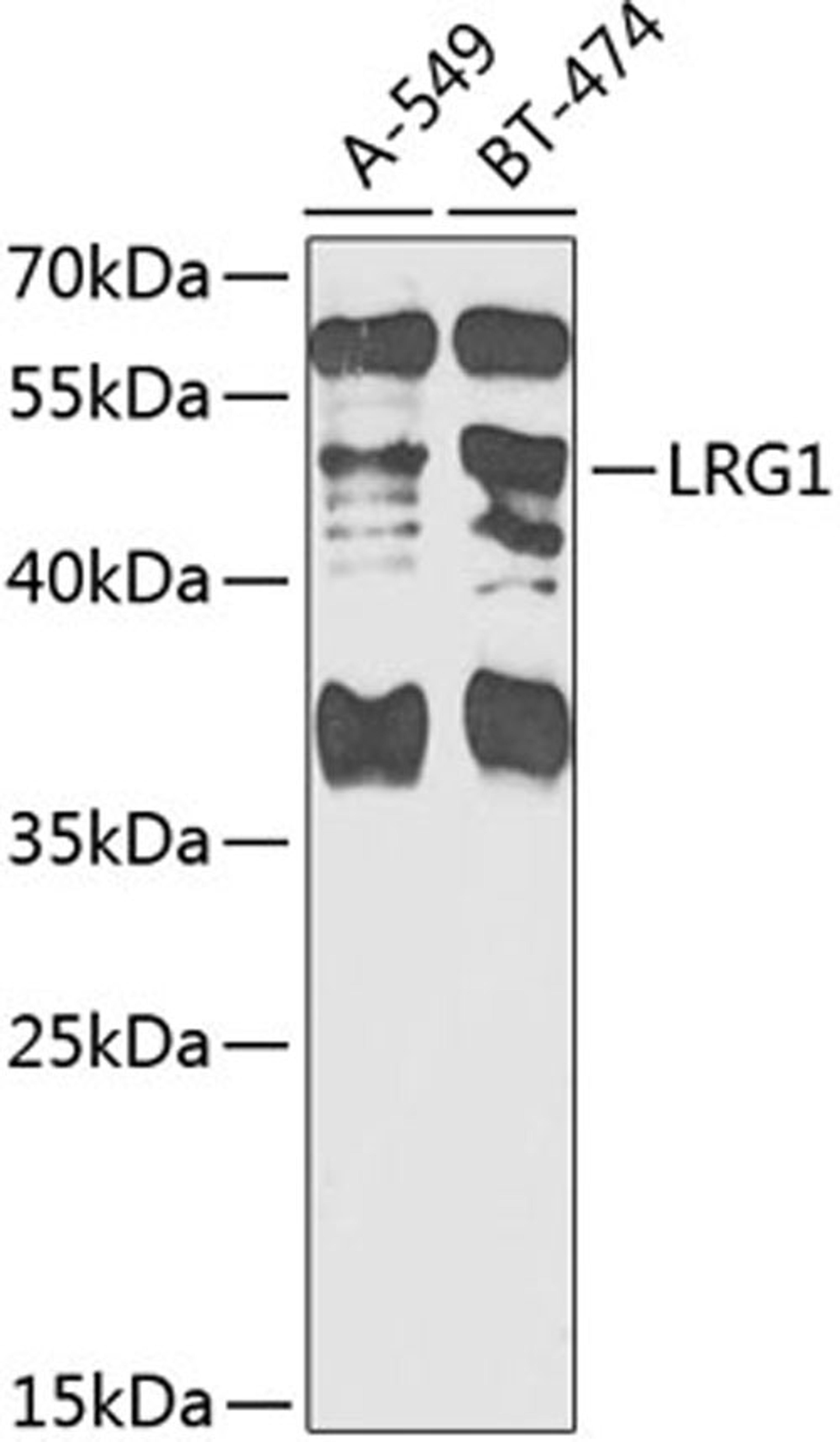 Western blot - LRG1 antibody (A7850)