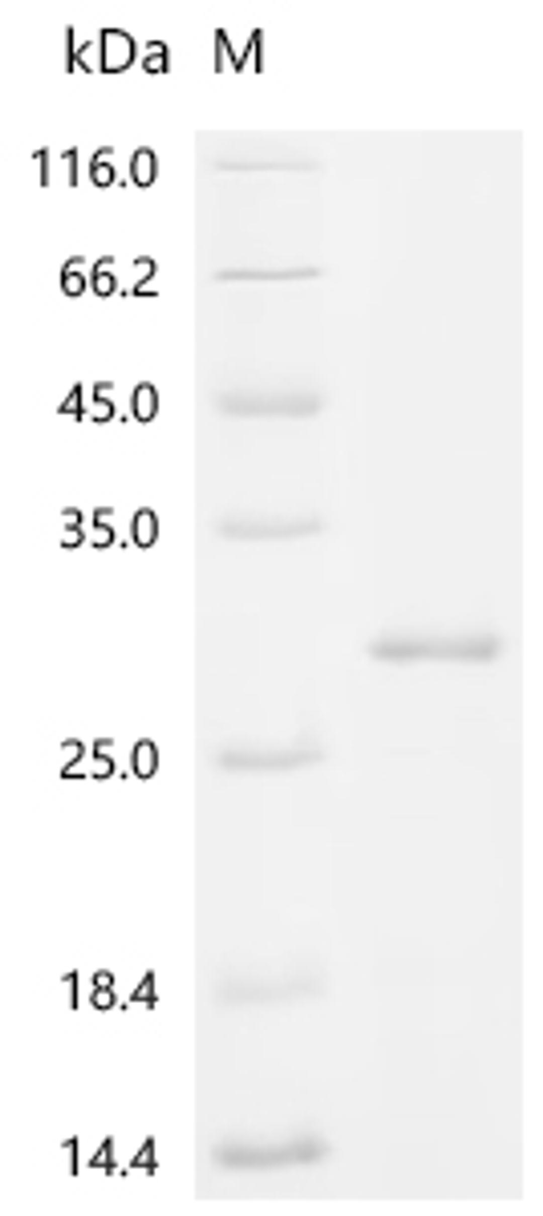 (Tris-Glycine gel) Discontinuous SDS-PAGE (reduced) with 5% enrichment gel and 15% separation gel.