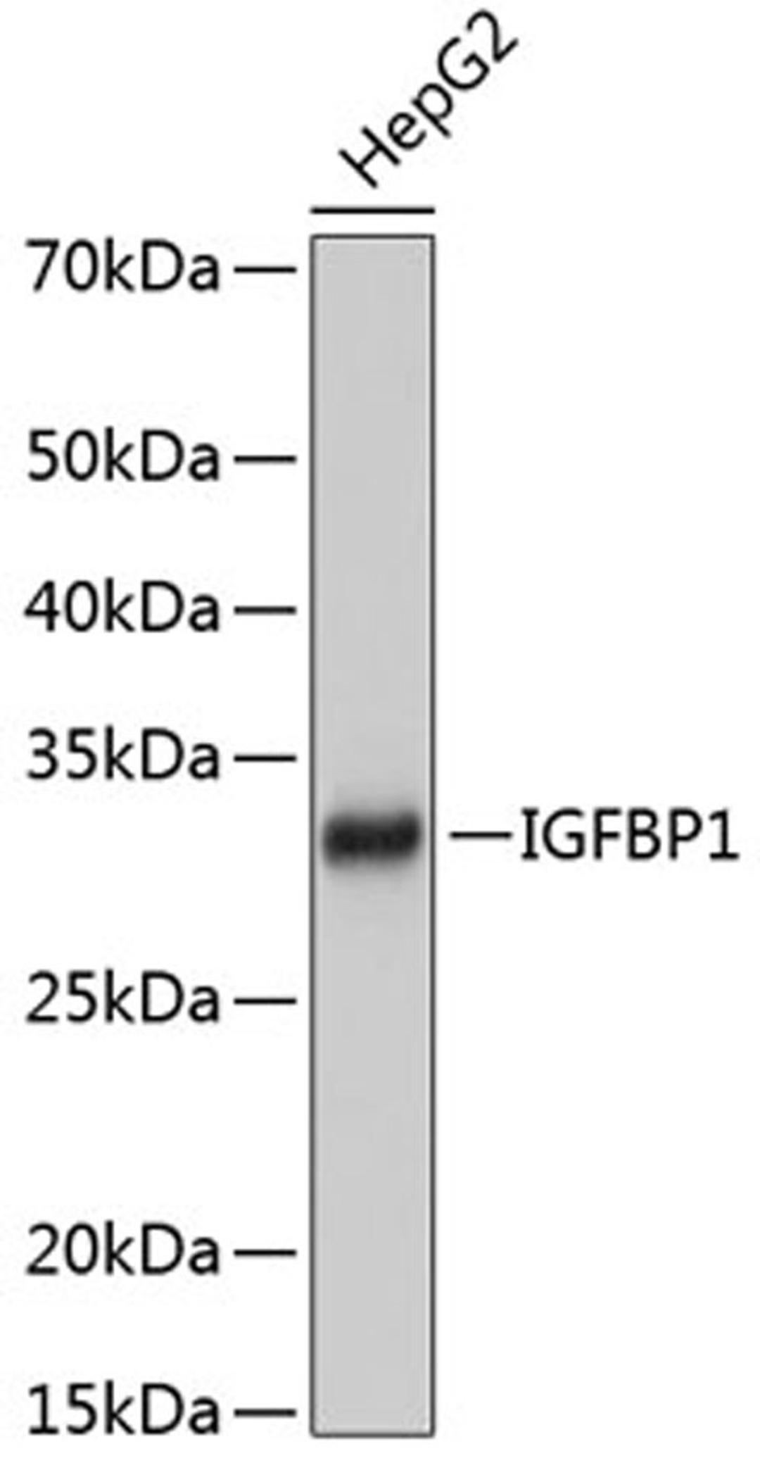 Western blot - IGFBP1 Rabbit mAb (A11672)