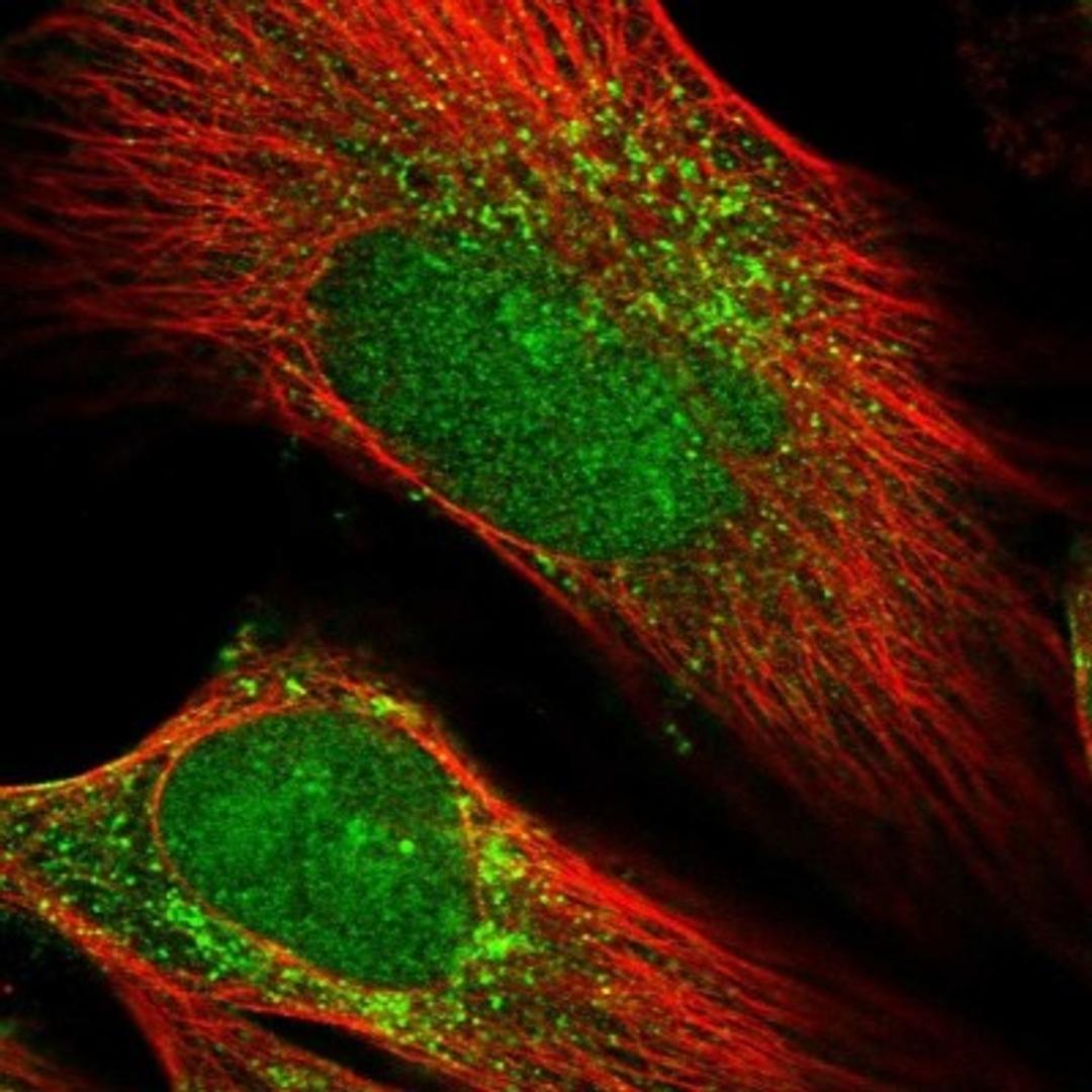 Immunofluorescence: PRUNE2 Antibody [NBP1-89335] - Immunofluorescent staining of human cell line U-251 MG shows positivity in nucleus & vesicles.