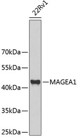 Western blot - MAGEA1 antibody (A5470)