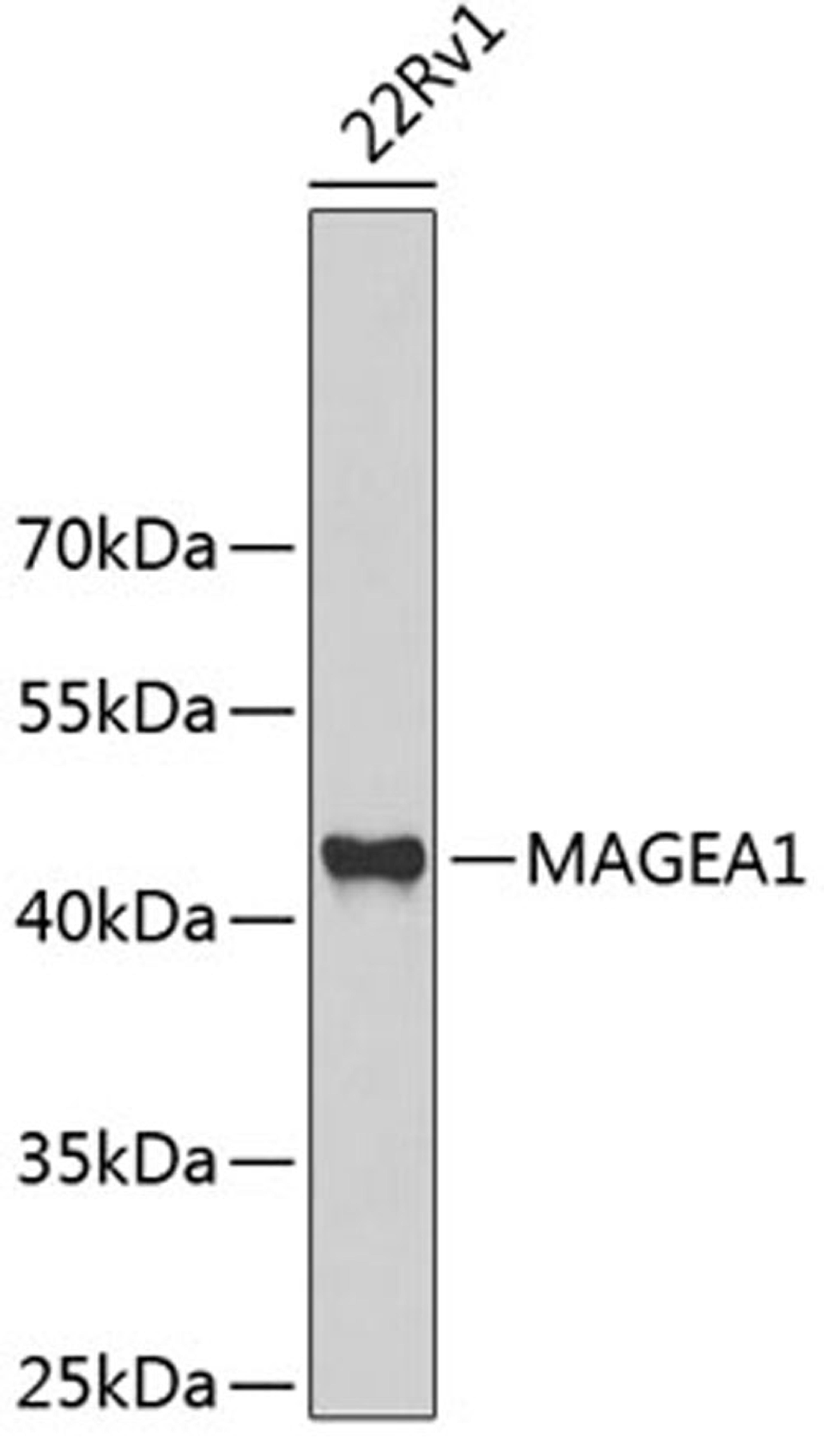 Western blot - MAGEA1 antibody (A5470)