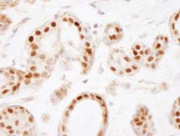 Detection of human Estrogen Receptor Alpha by immunohistochemistry.