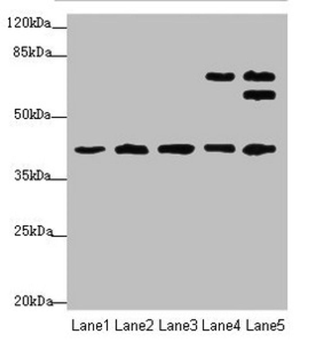 Western blot. All lanes: IKBIPantibody at 4.49ug/ml. Lane 1: Mouse kidney tissue. Lane 2: Mouse lung tissue. Lane 3: Mouse spleen tissue. Lane 4: HL60 whole cell lysate. Lane 5: HepG2 whole cell lysate. Secondary. Goat polyclonal to rabbit IgG at 1/10000 dilution. Predicted band size: 40, 28, 8, 44 kDa. Observed band size: 40, 67, 63 kDa. 